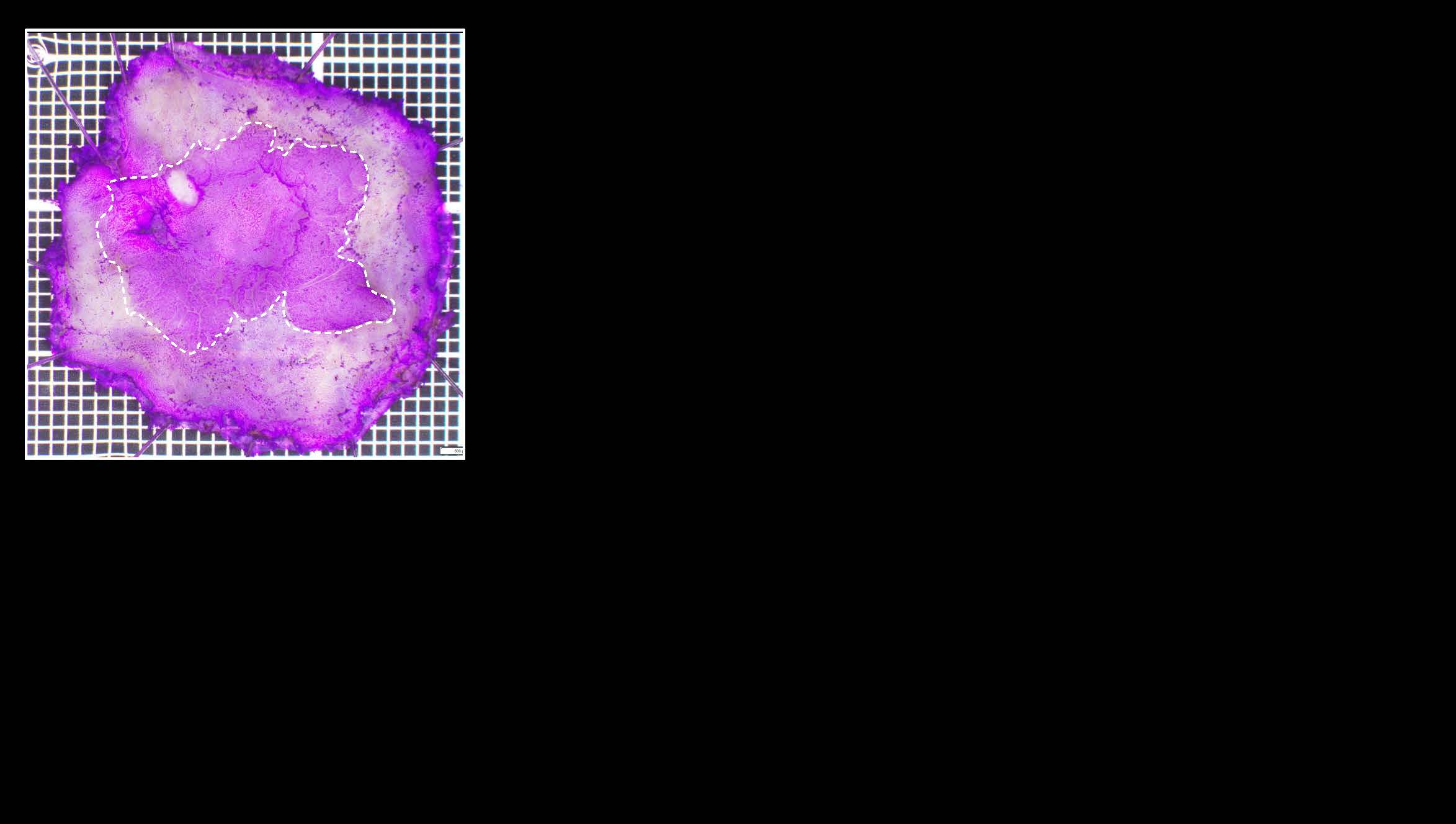 大腸094