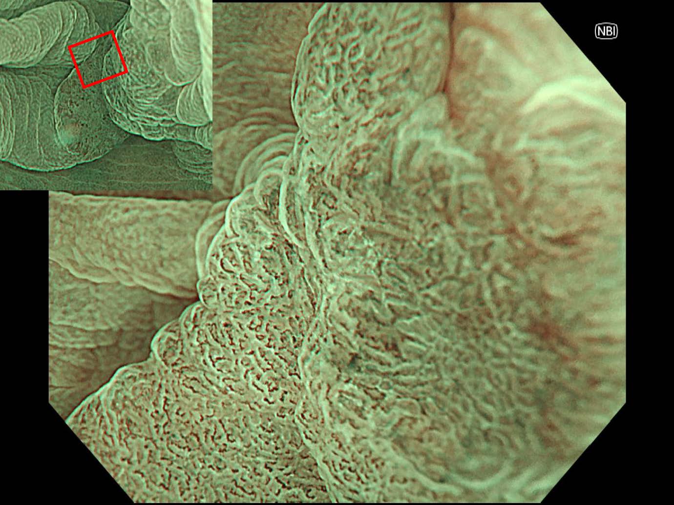 大腸013
