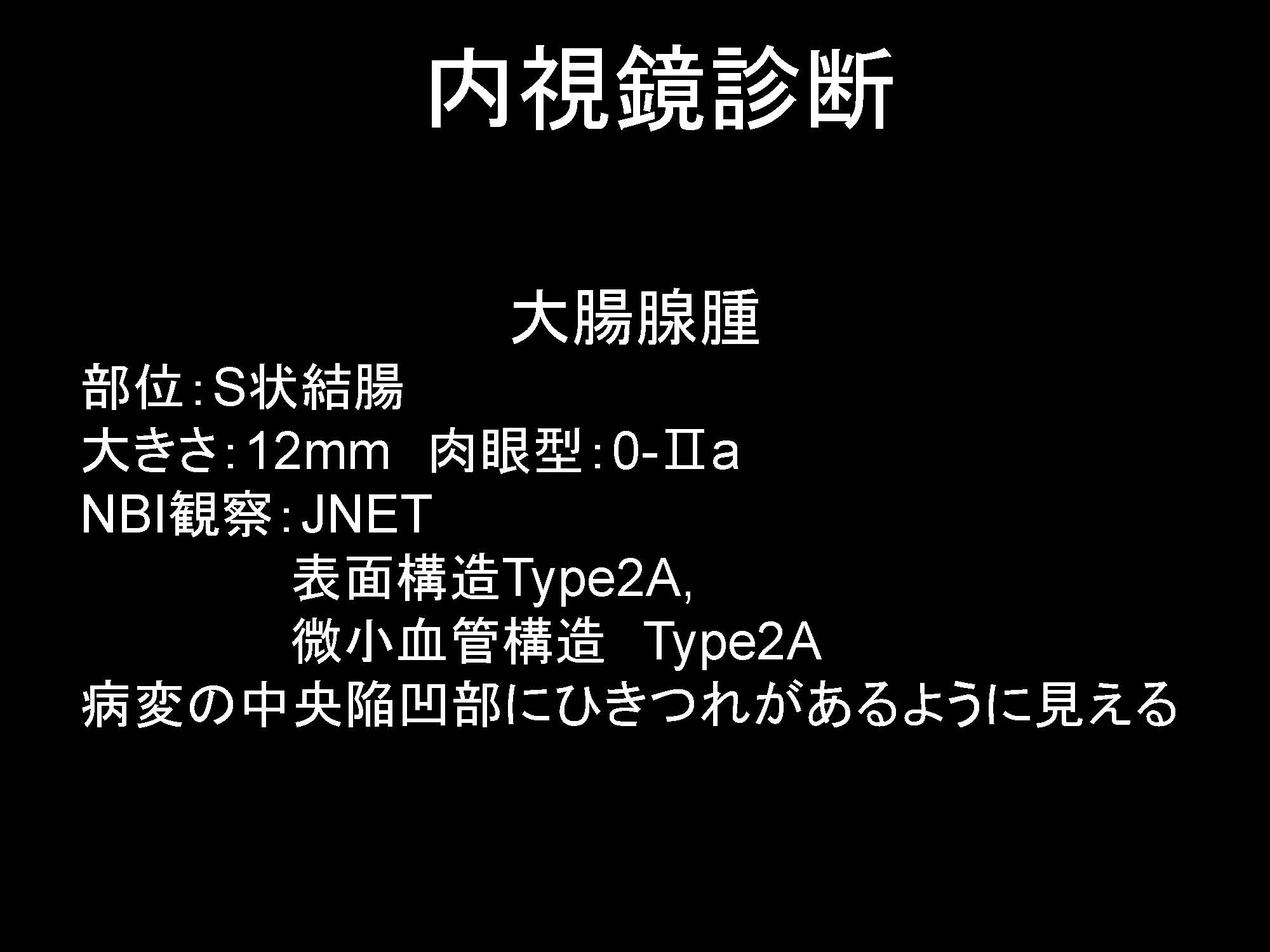 大腸014