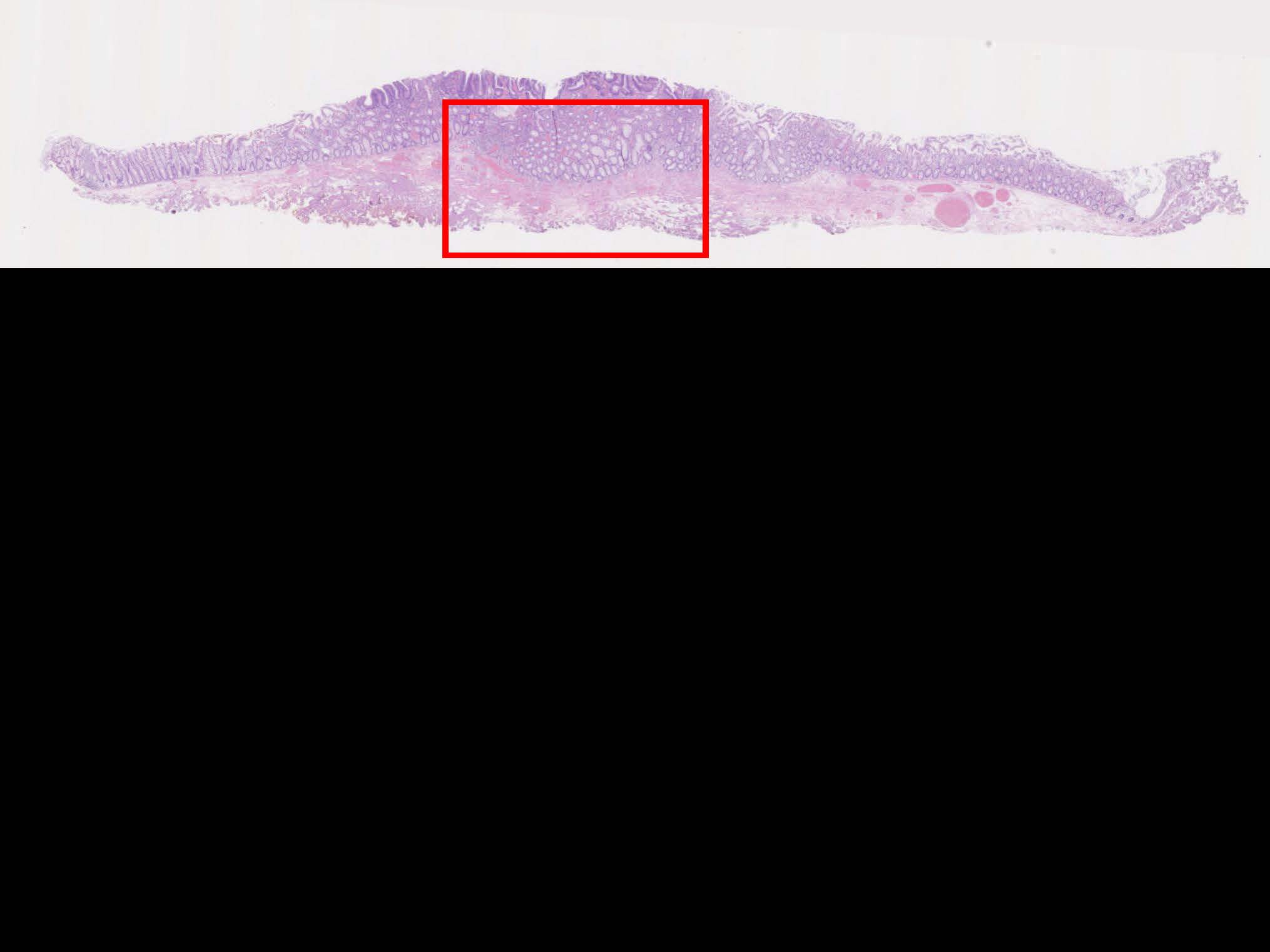 大腸054