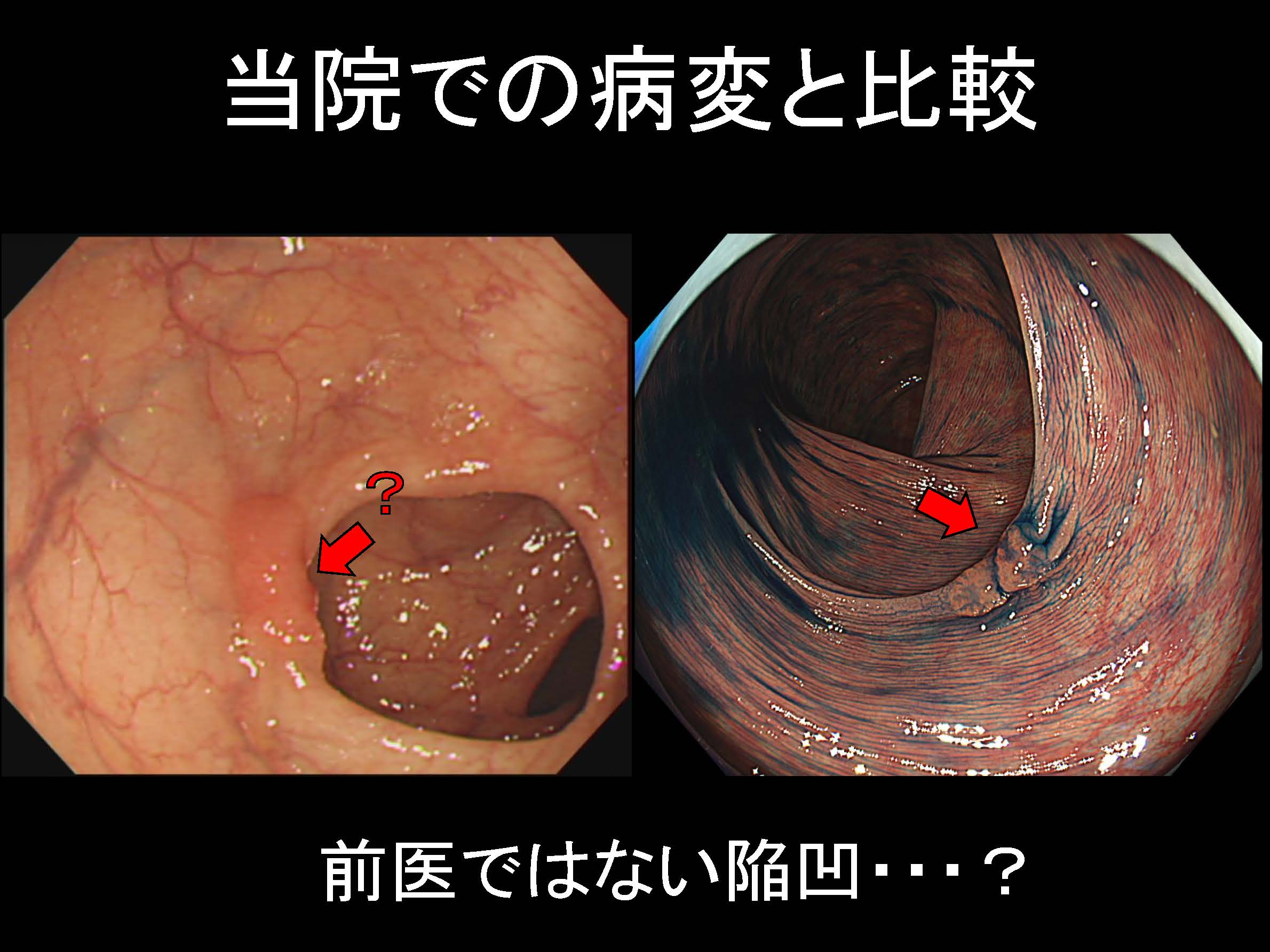 大腸060