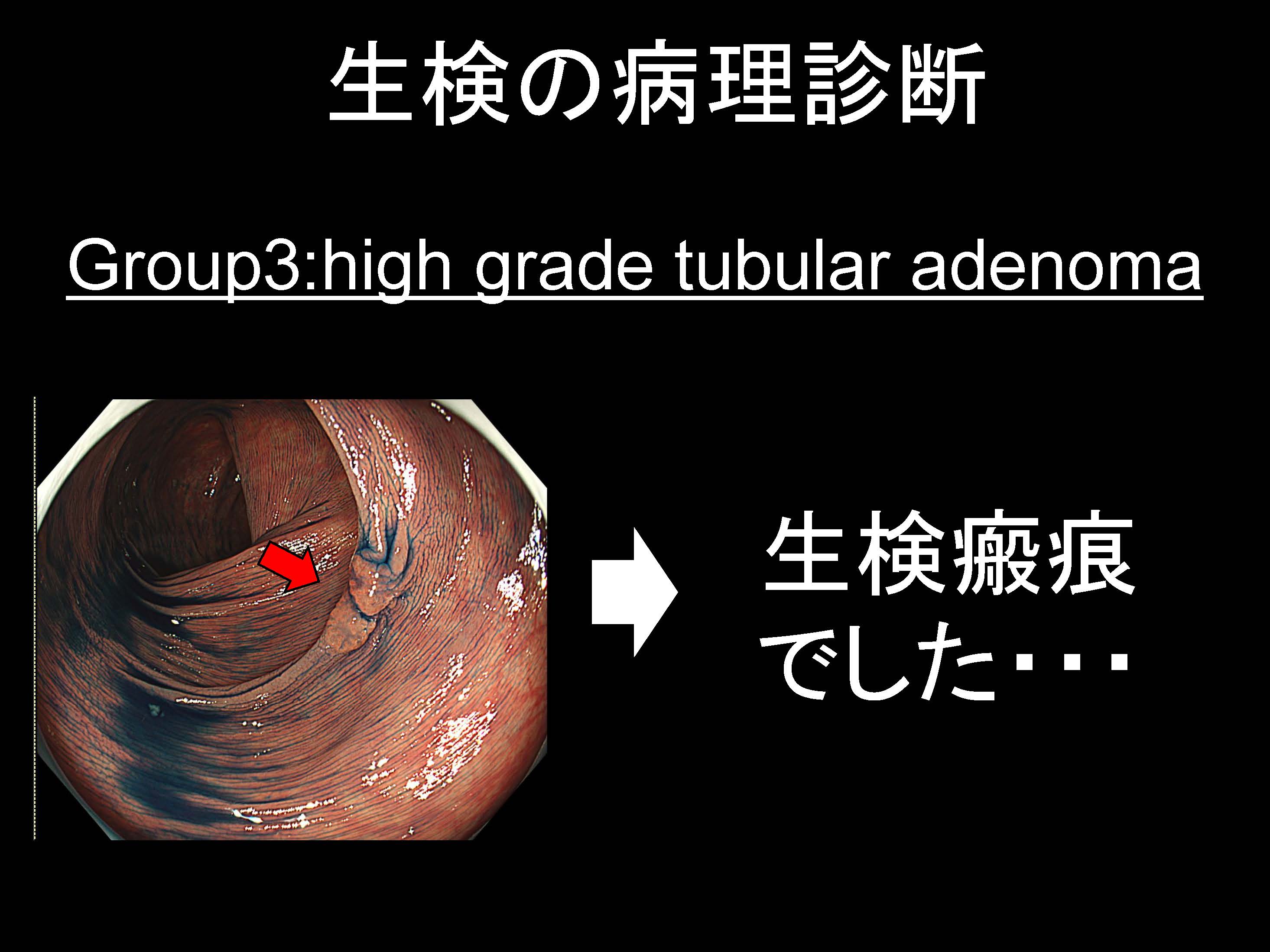 大腸061
