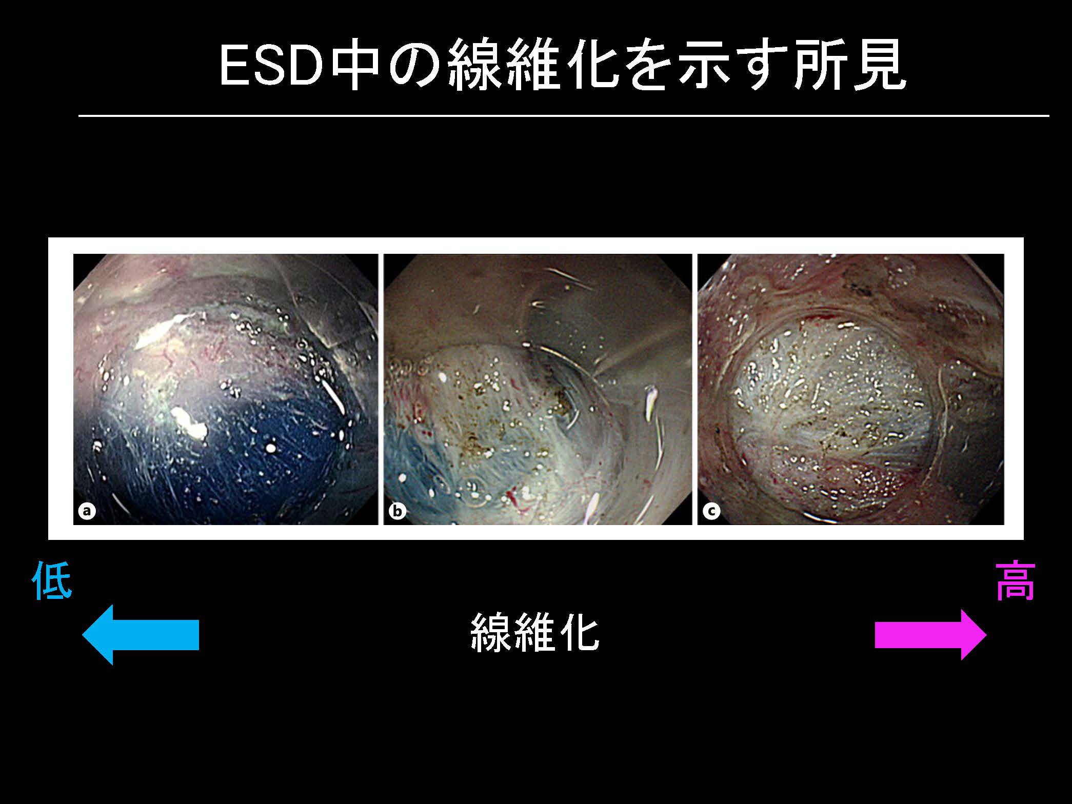 大腸091