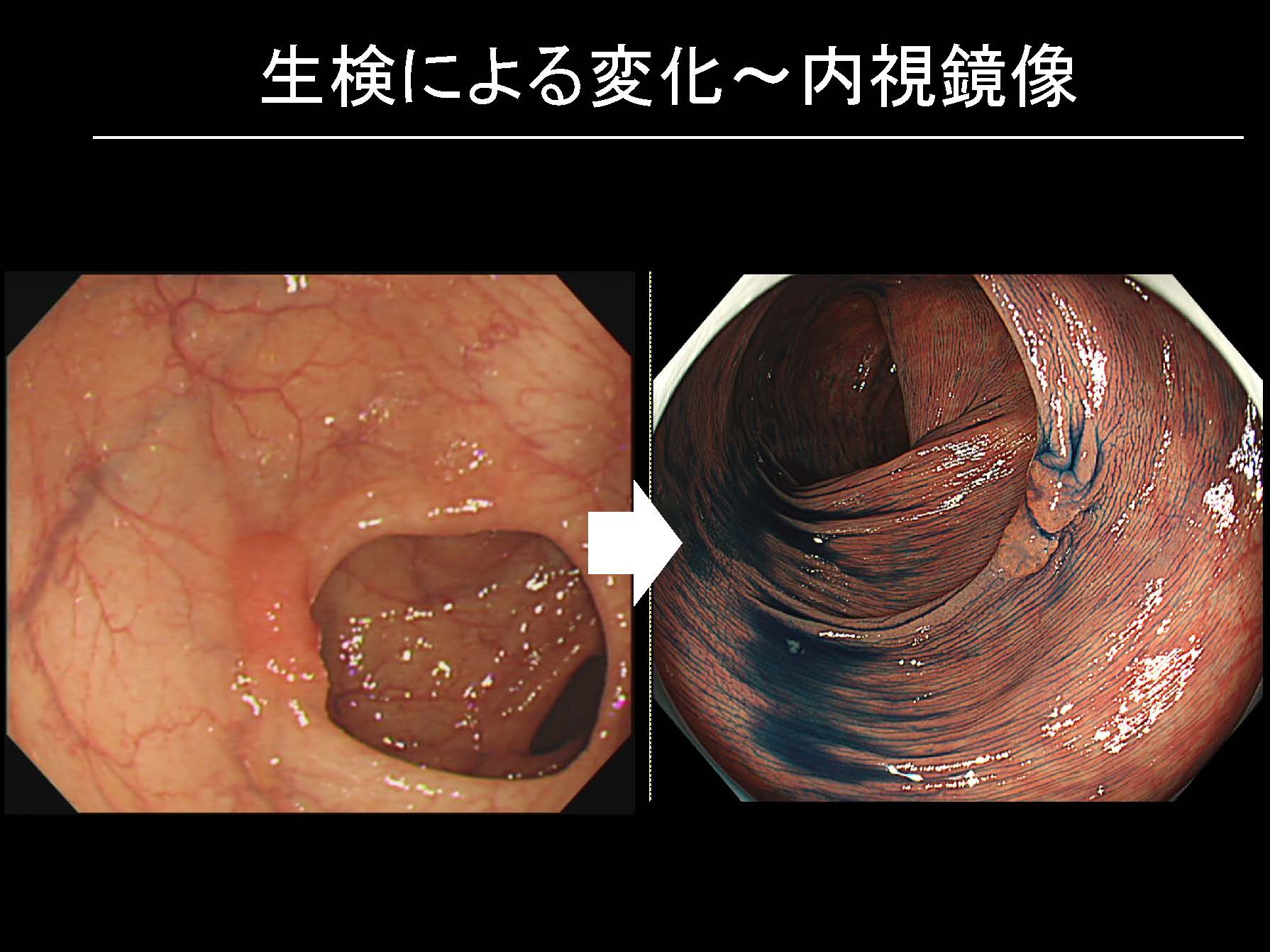 大腸103