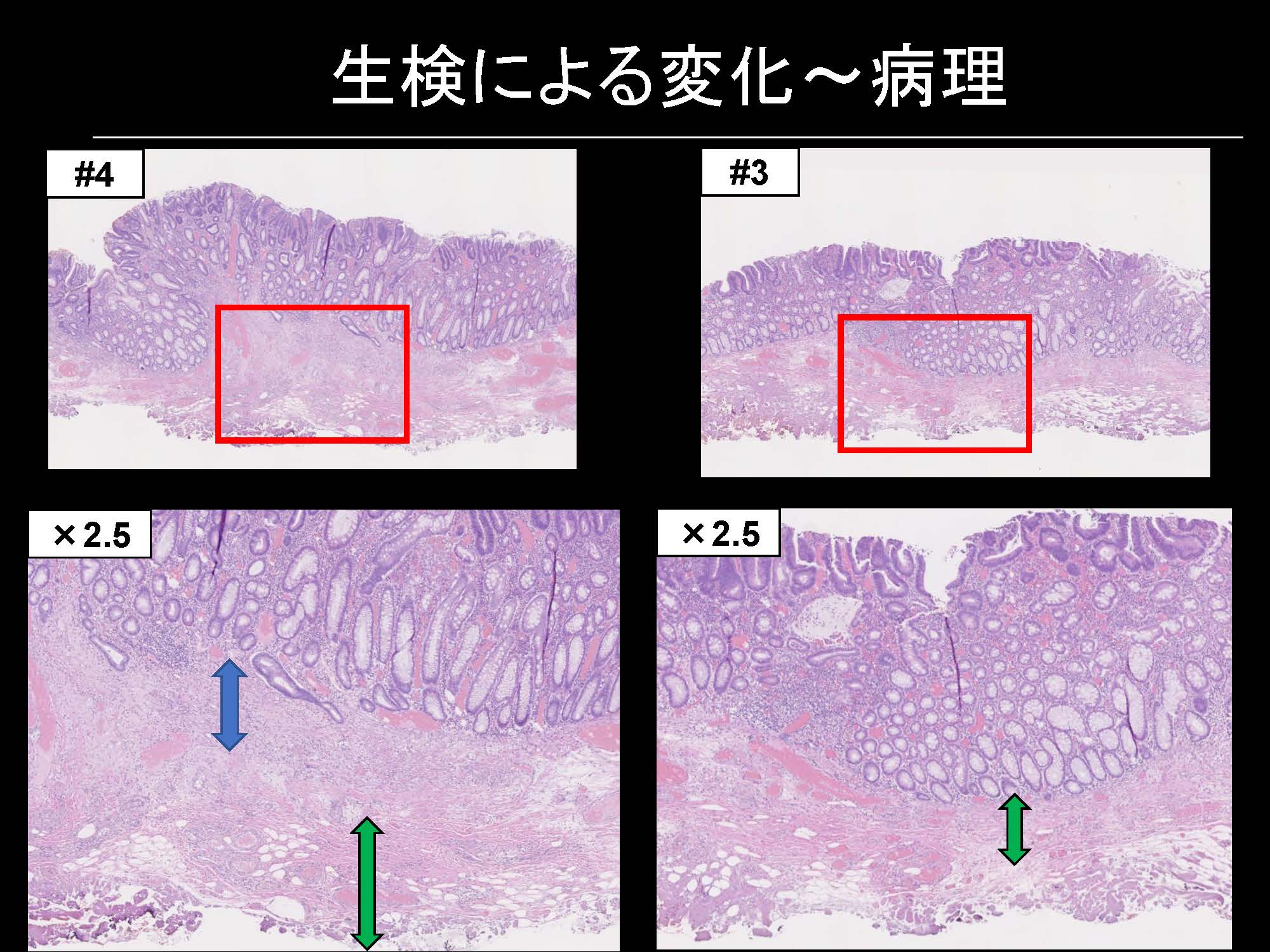 大腸105