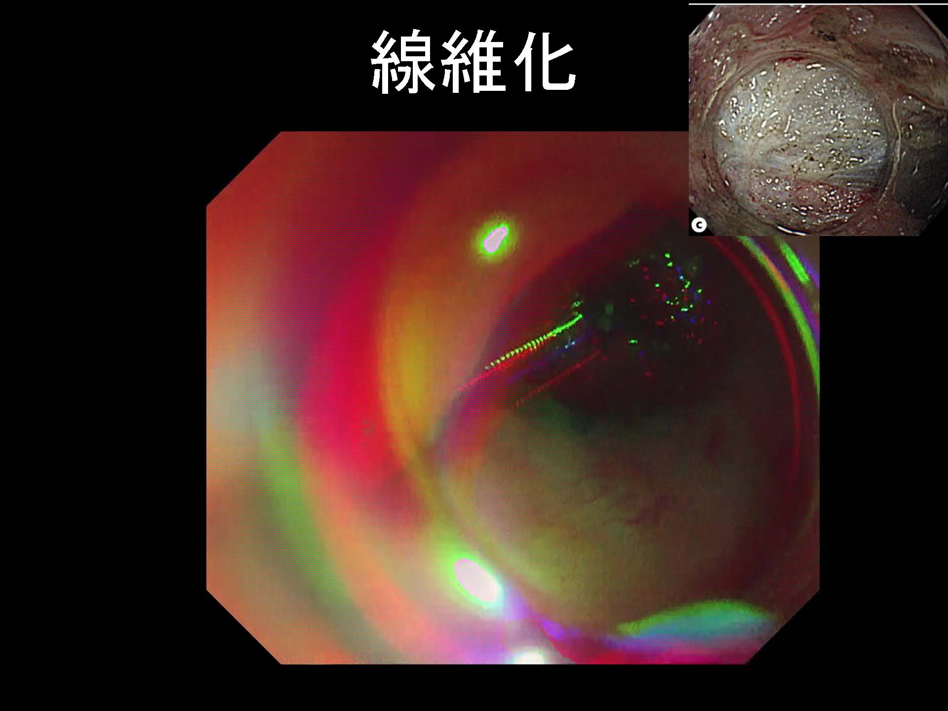 大腸106