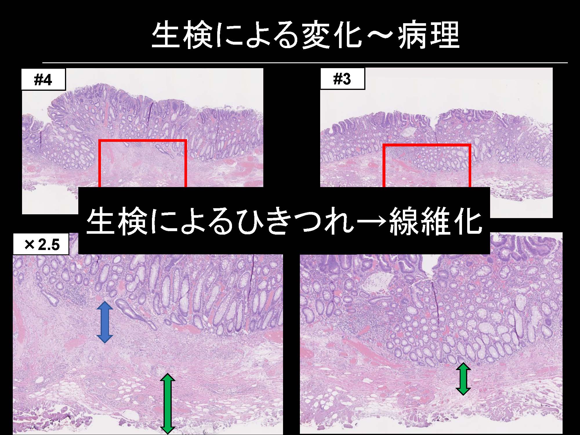 大腸107