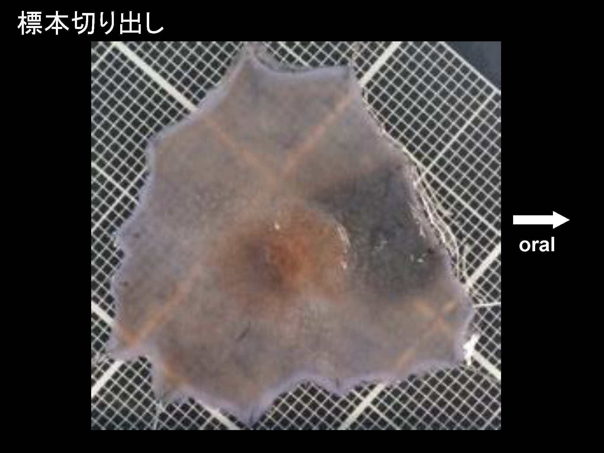 大腸022