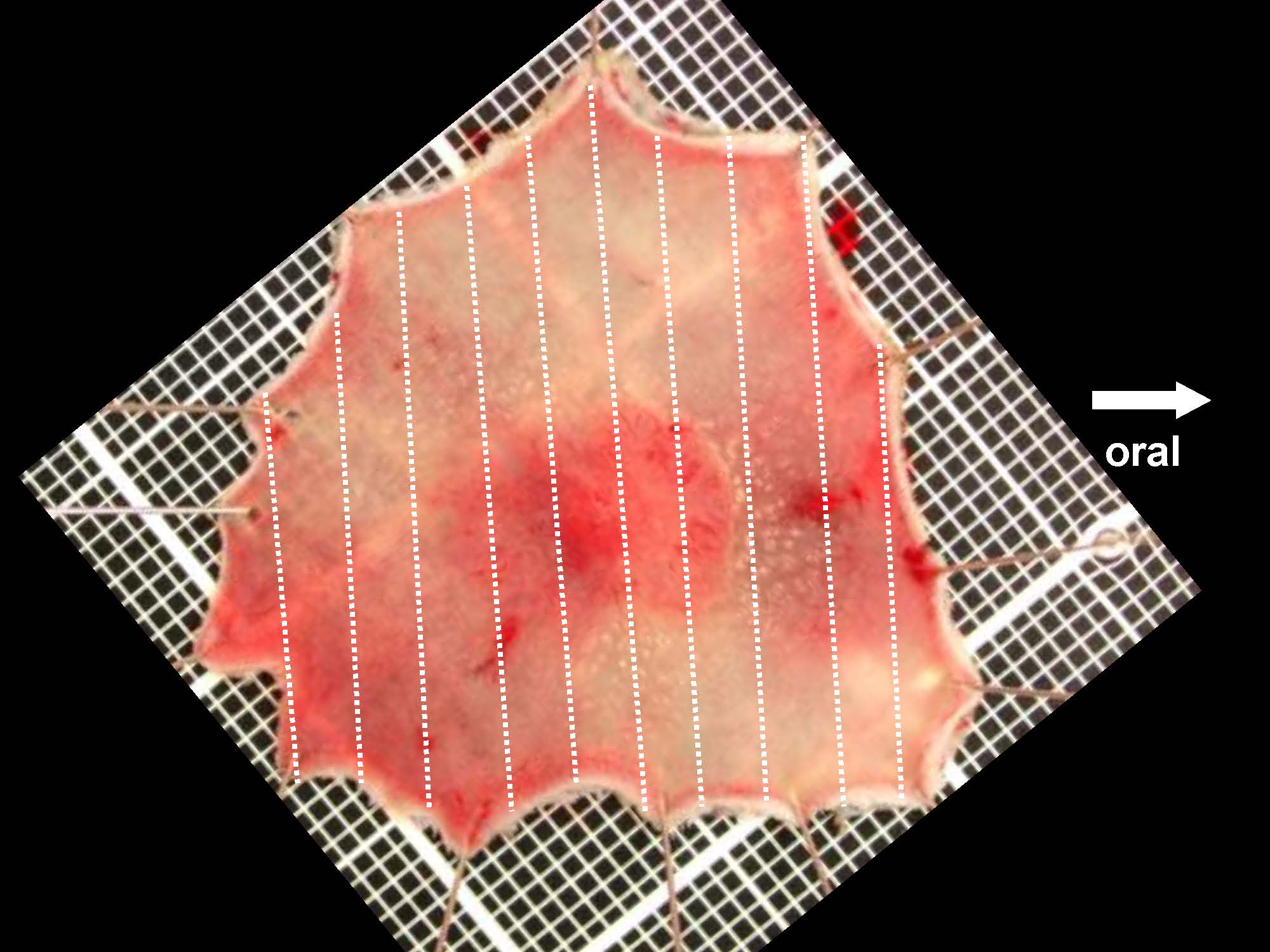 大腸026