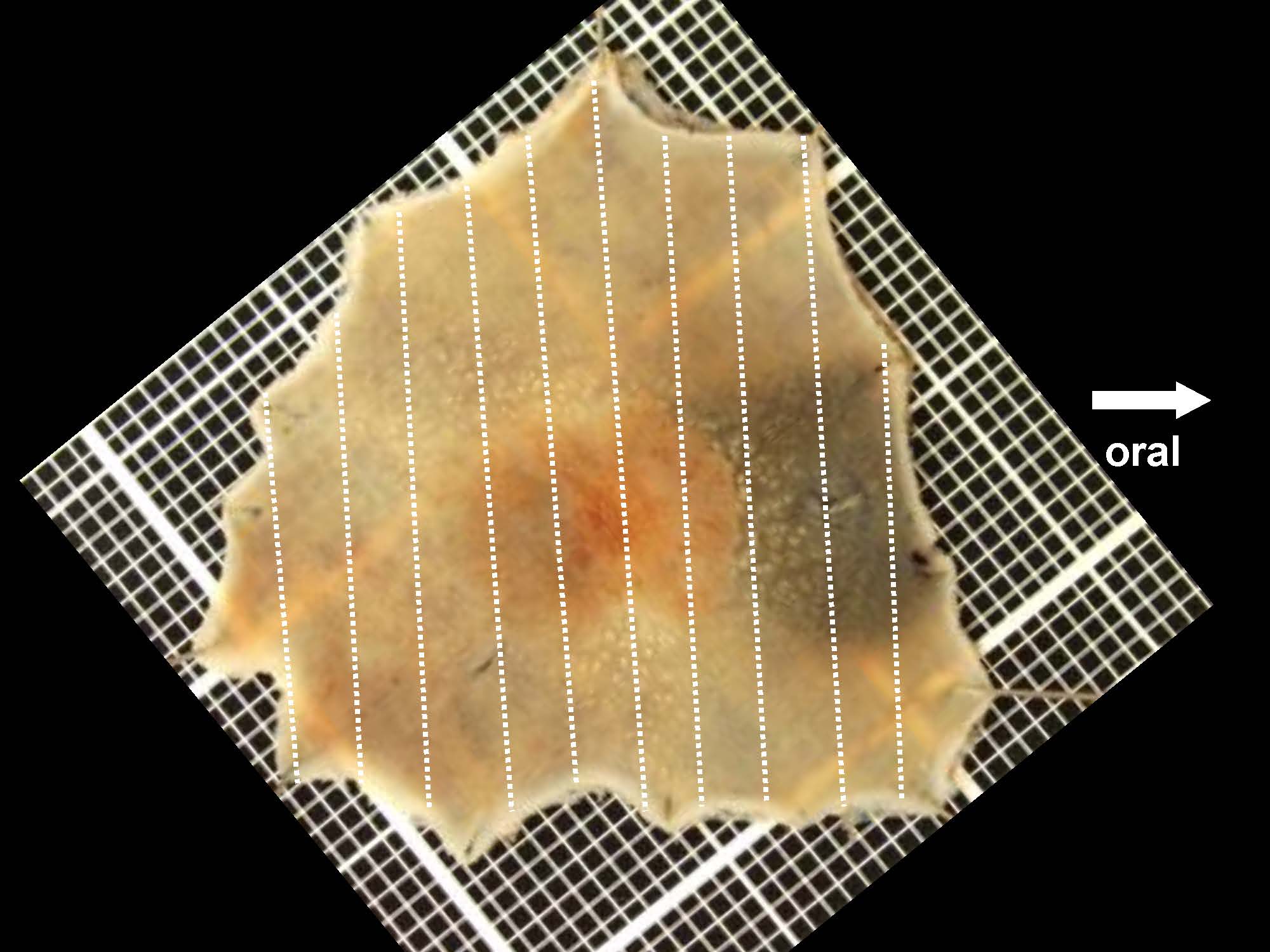 大腸030