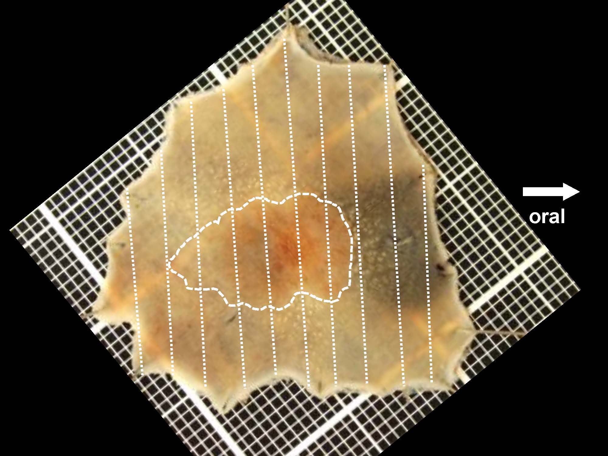 大腸031