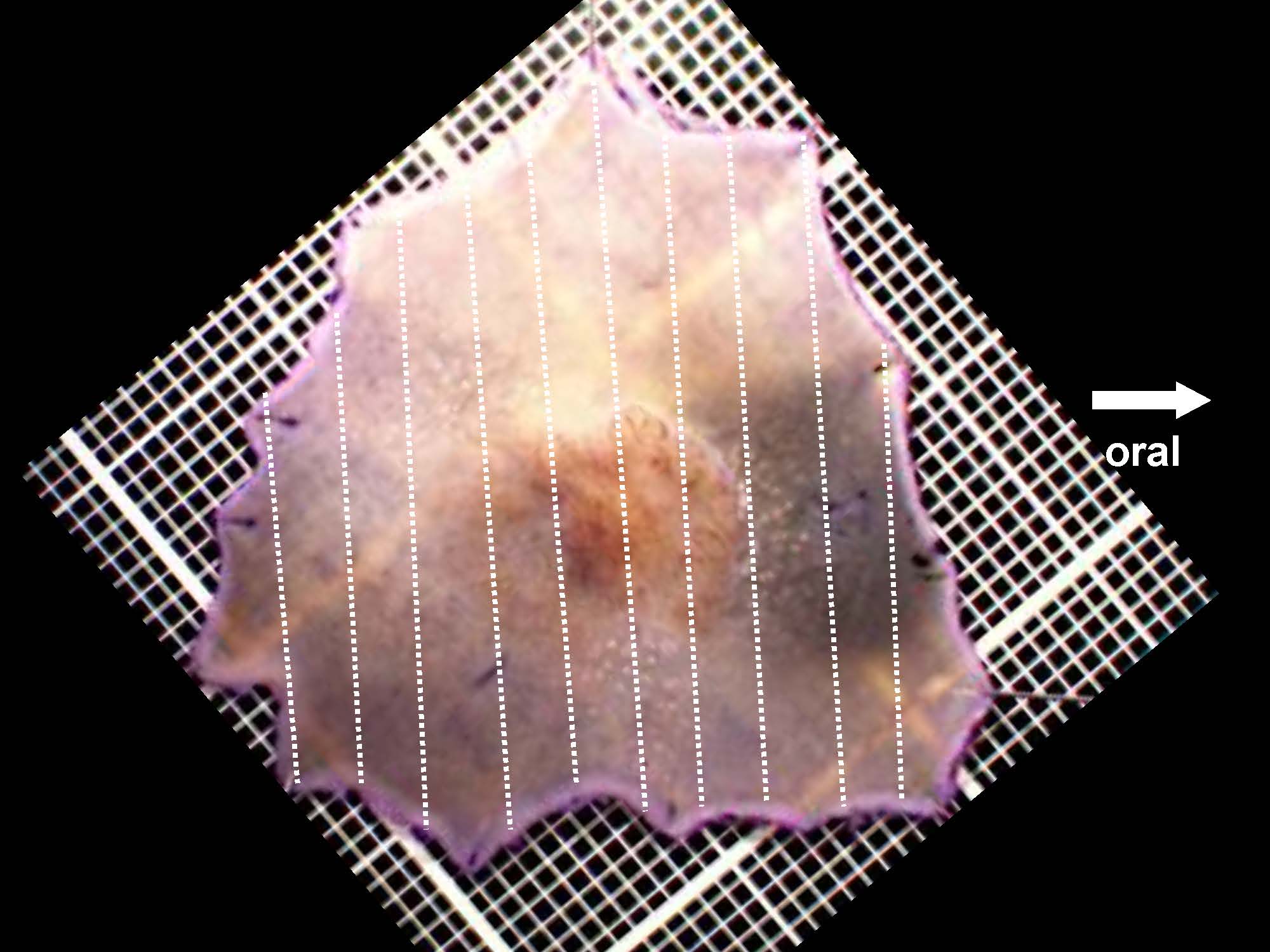 大腸034