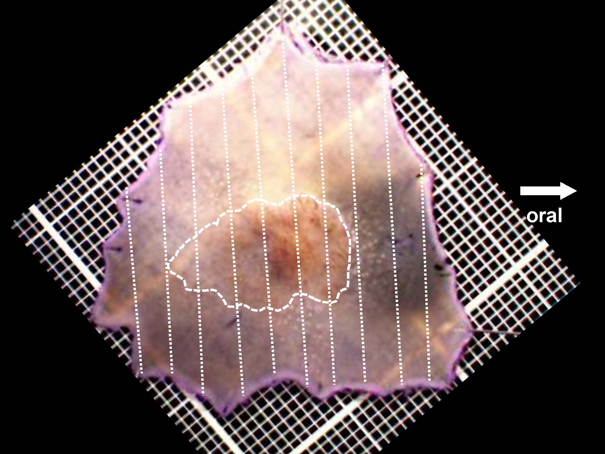 大腸035