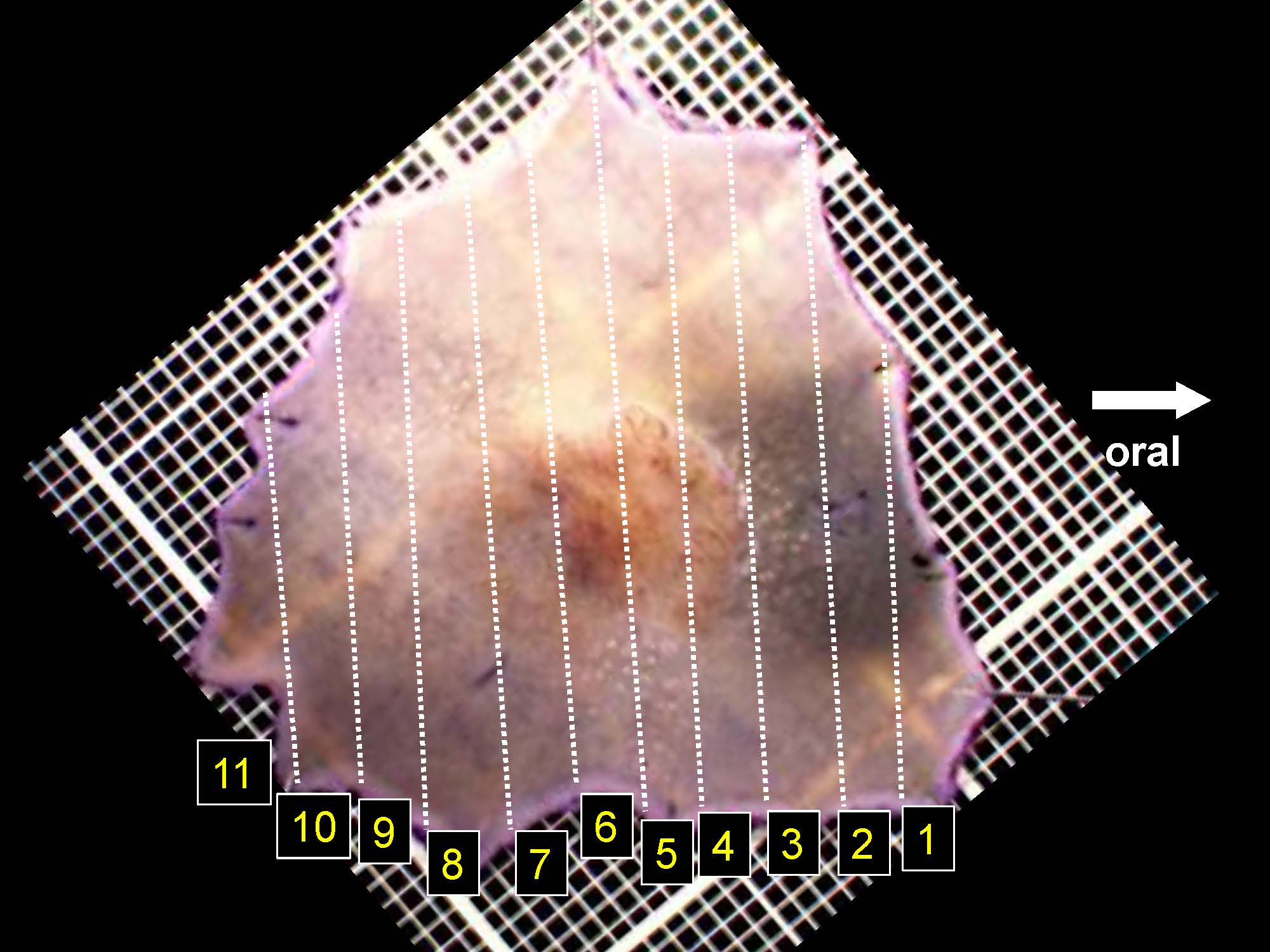 大腸036