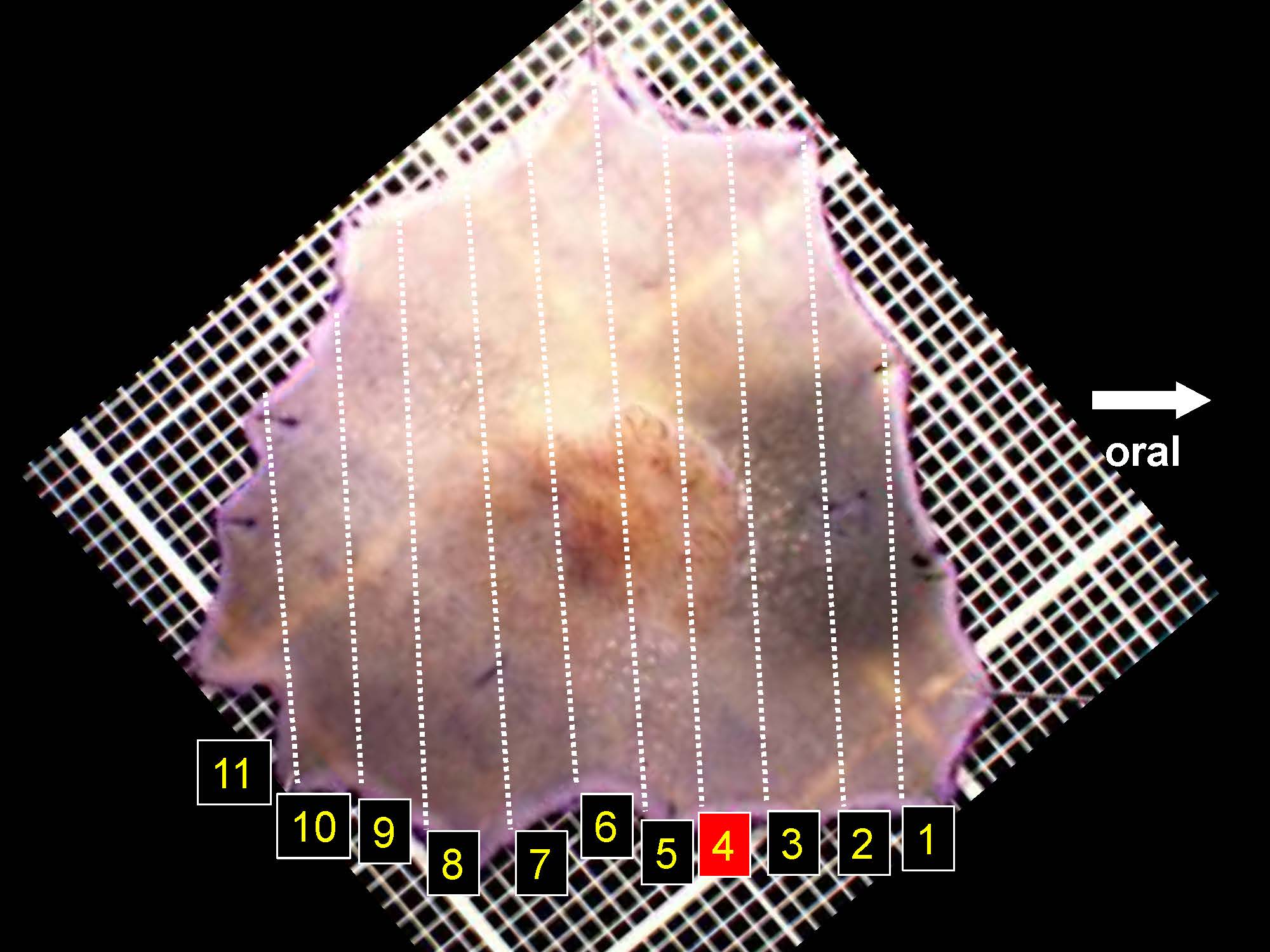 大腸037