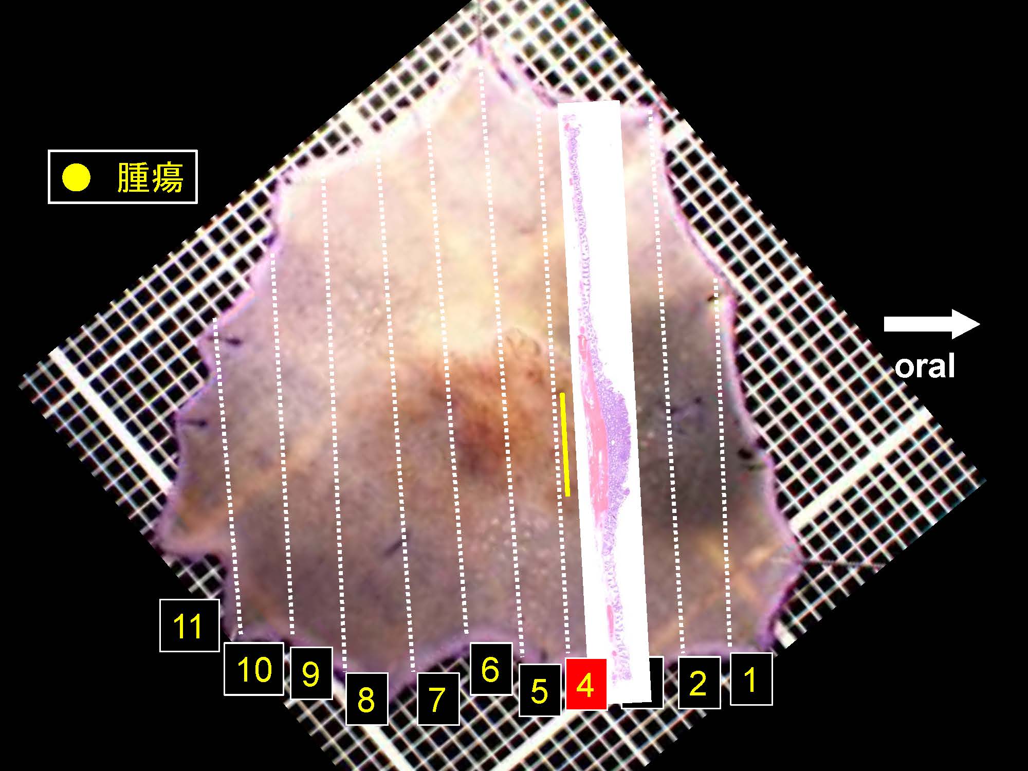 大腸038