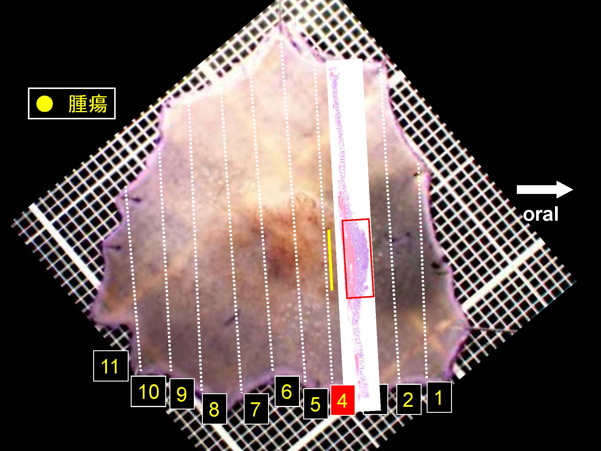 大腸039