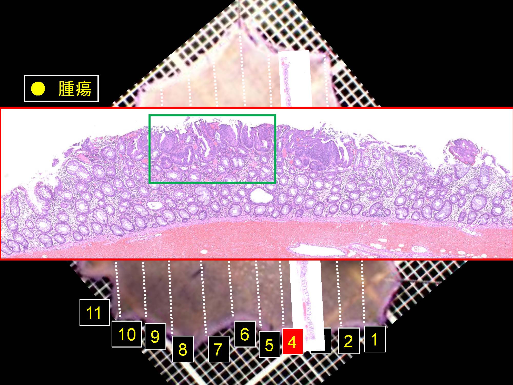大腸041