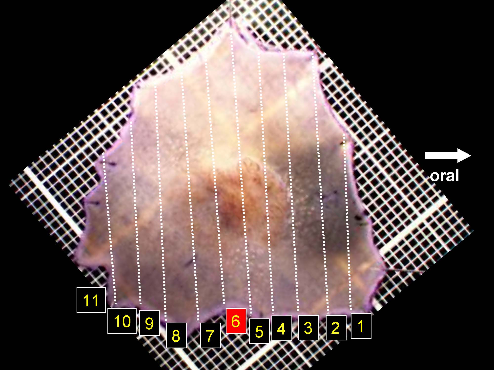 大腸043