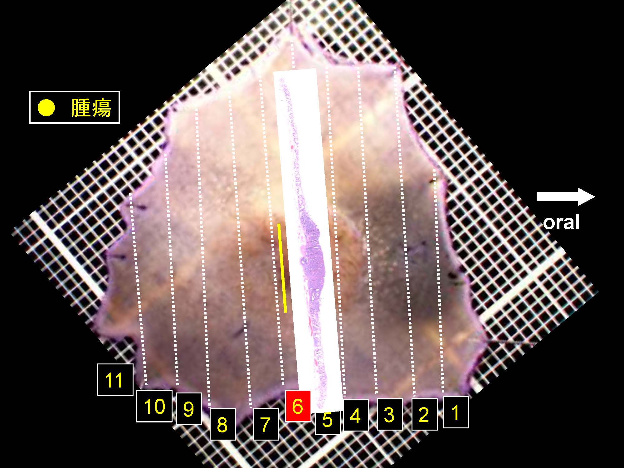 大腸045