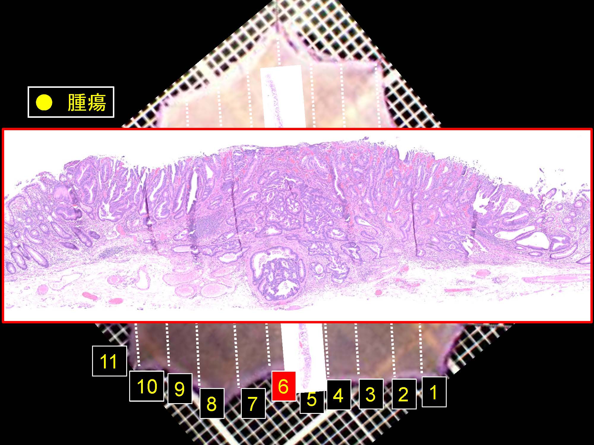 大腸047