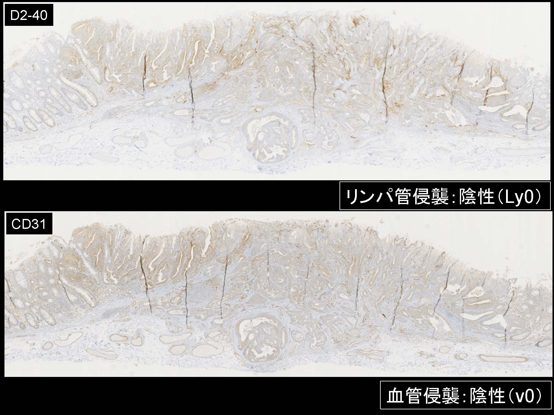 大腸049