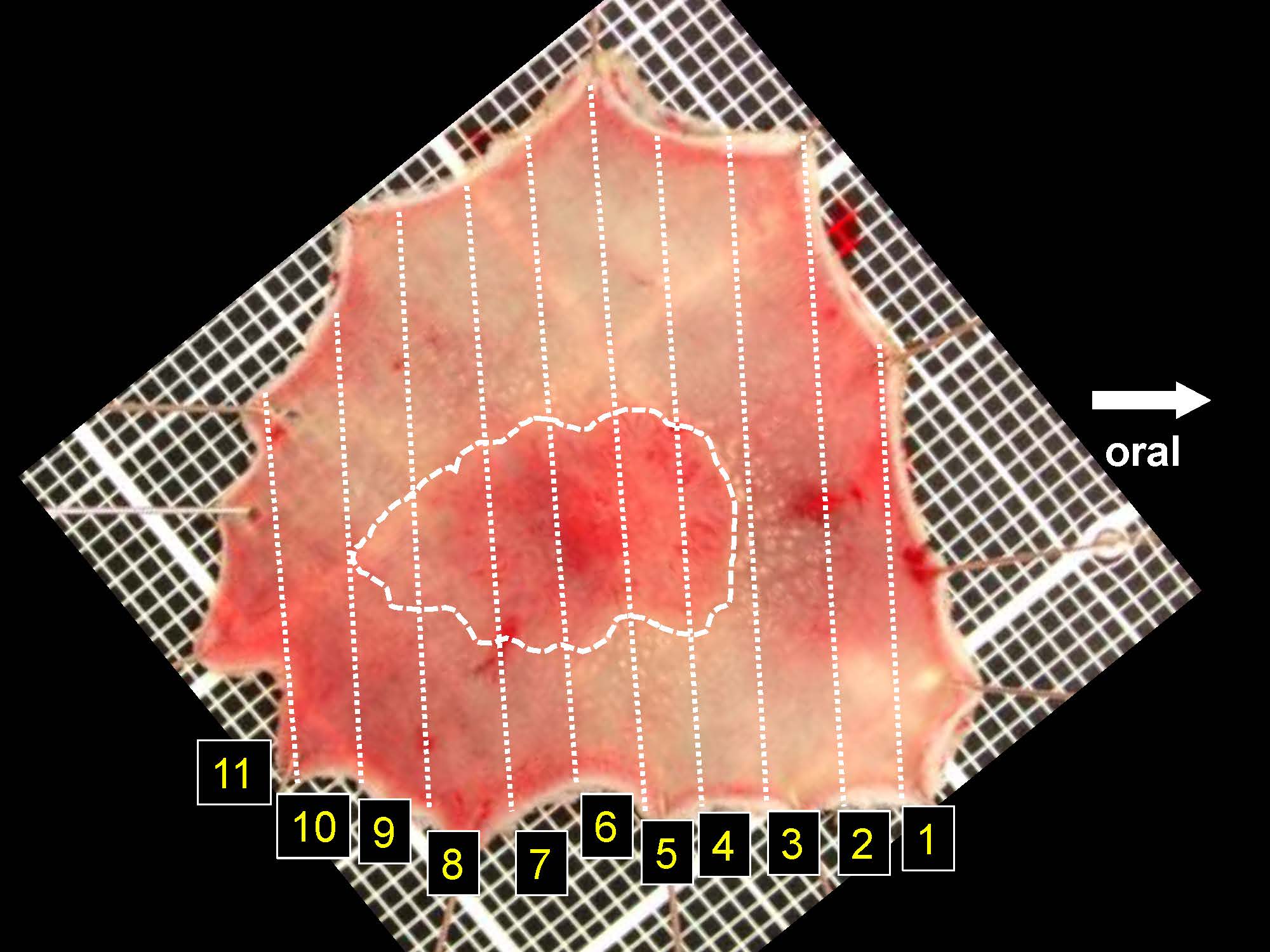 大腸051