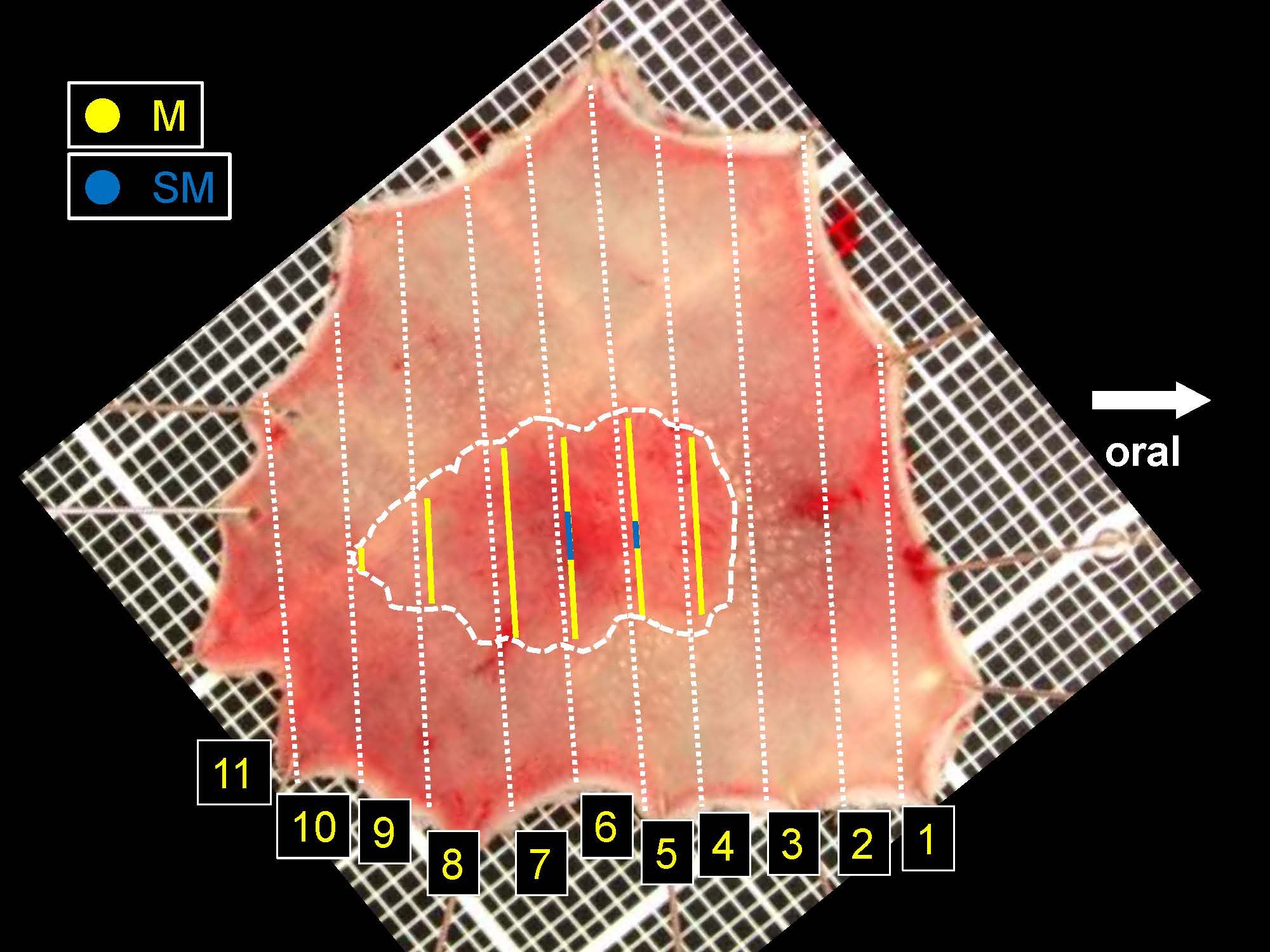 大腸052