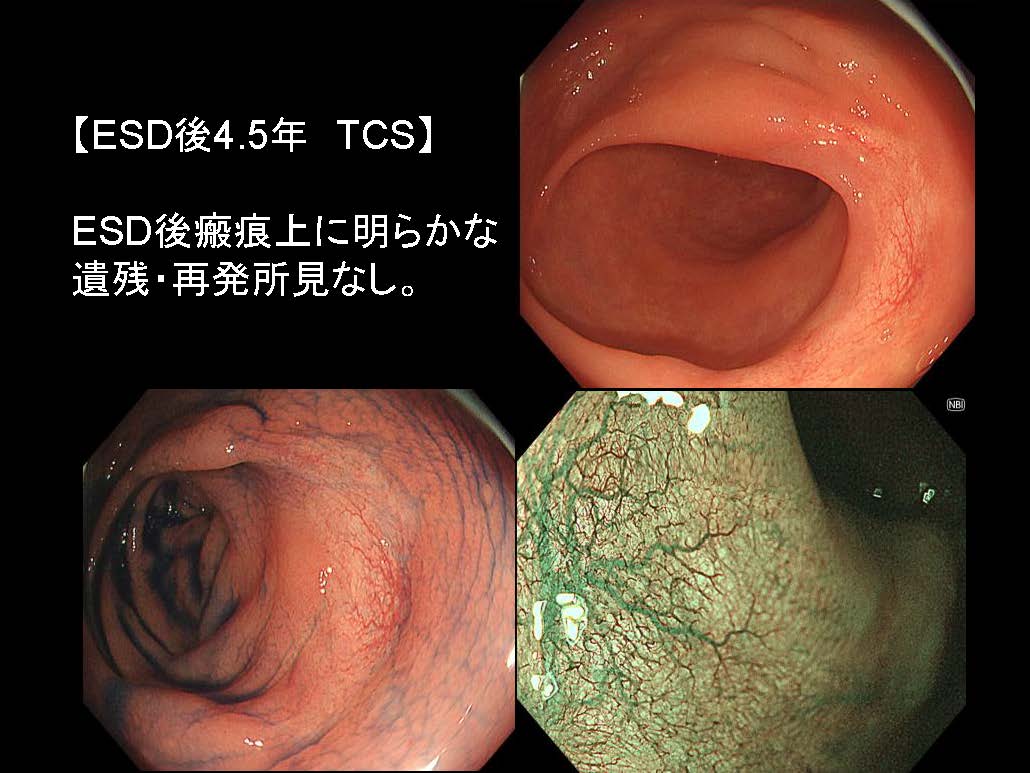 大腸069