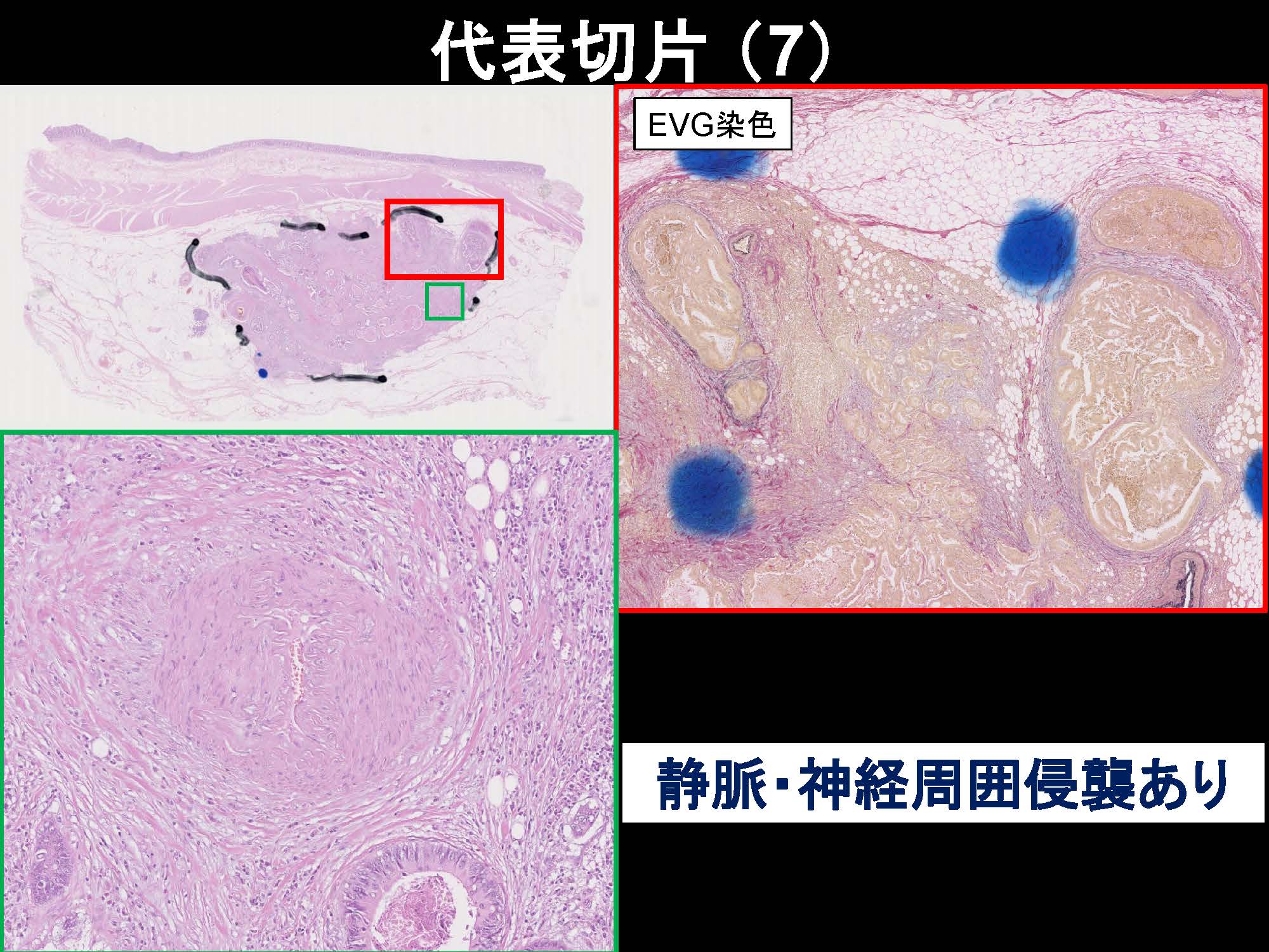 大腸078