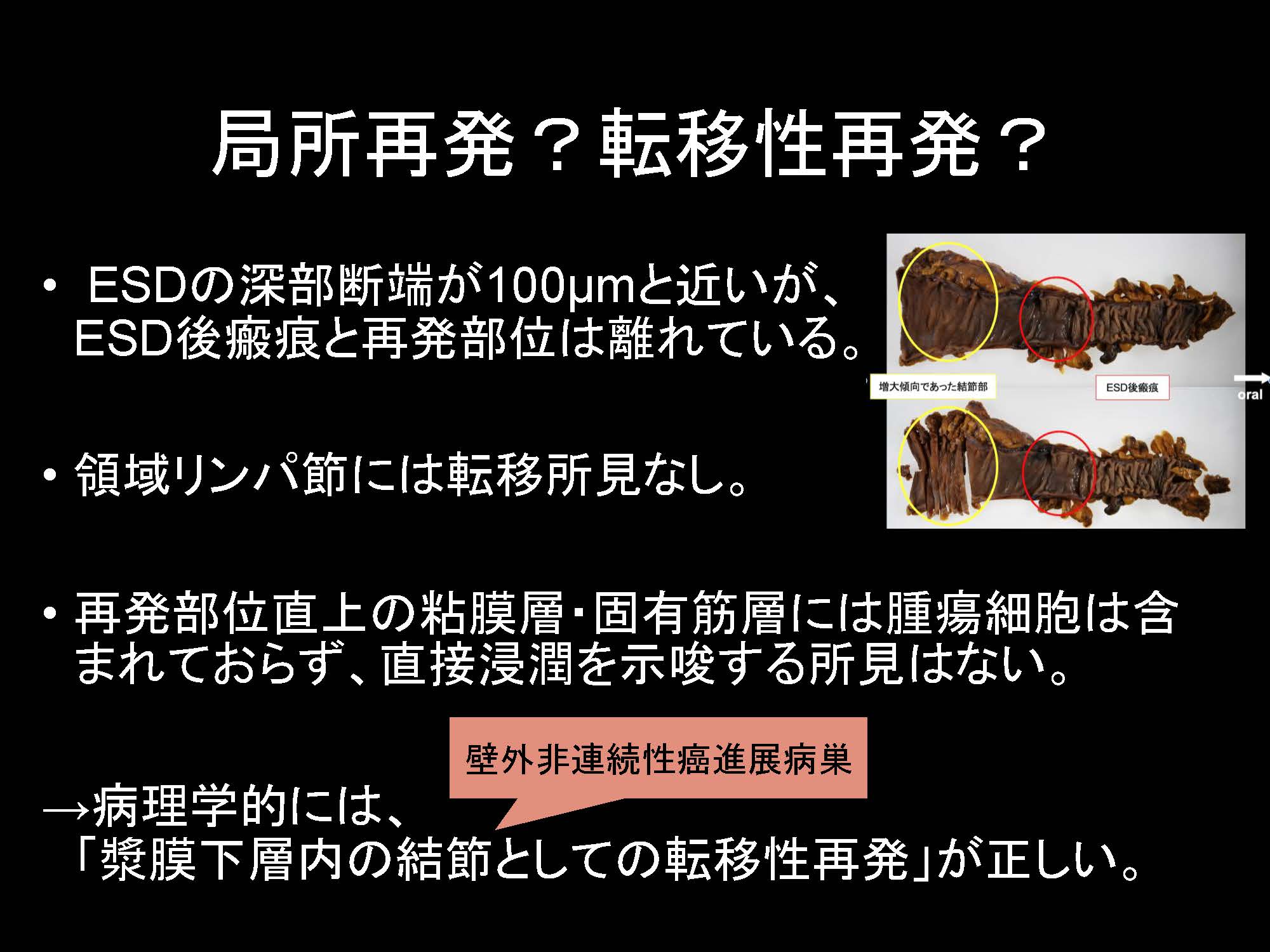 大腸080