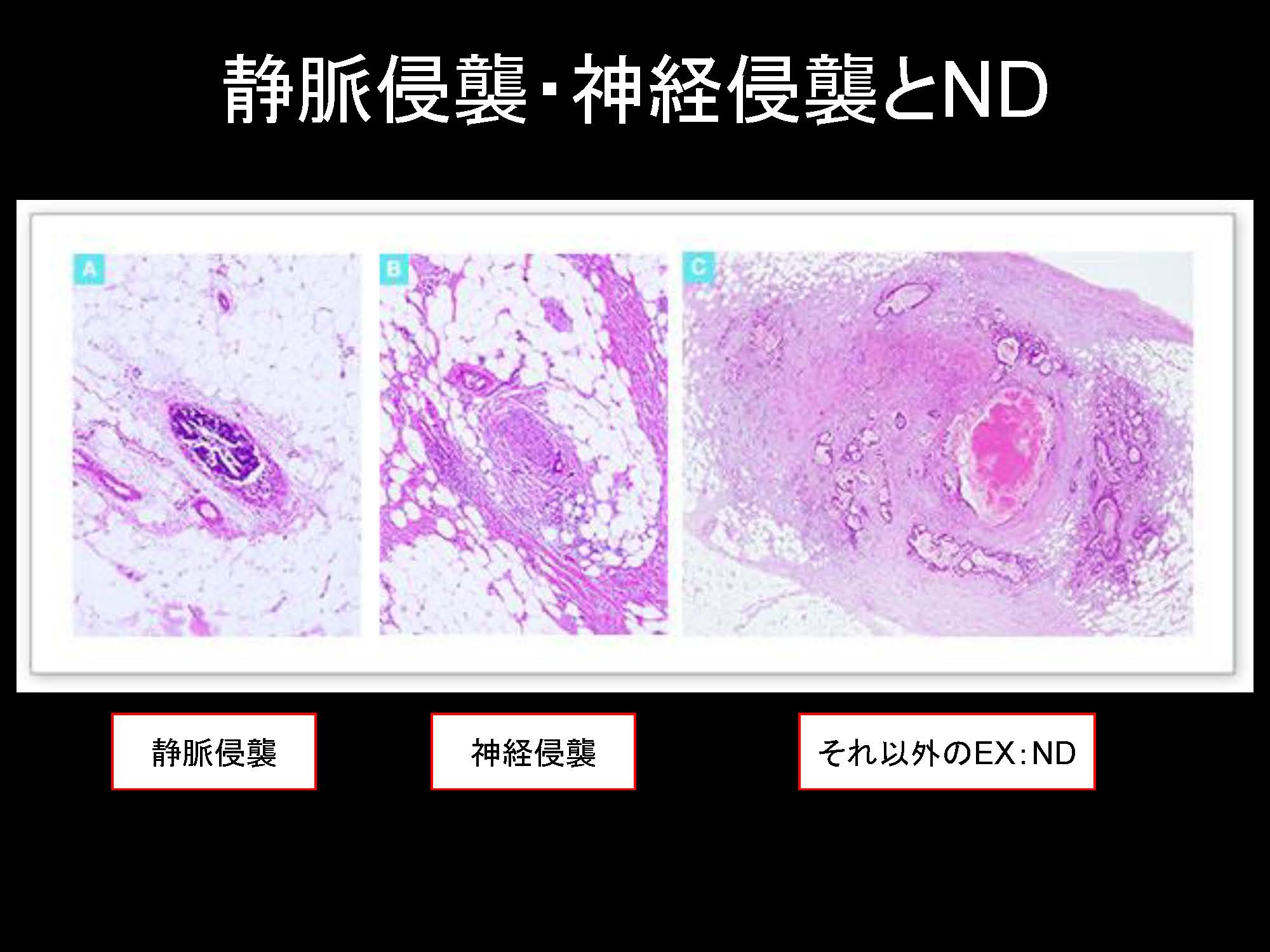 大腸083
