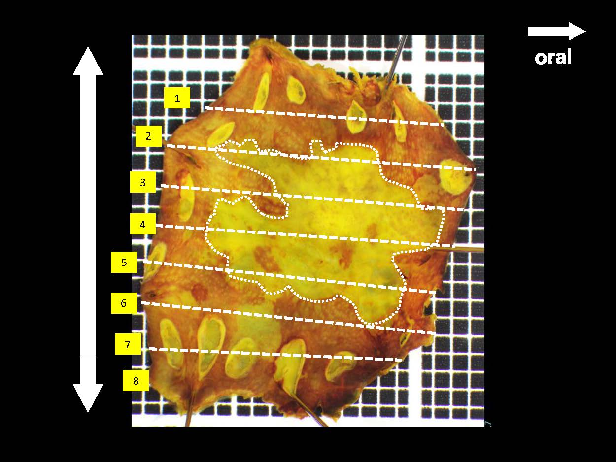 食道038