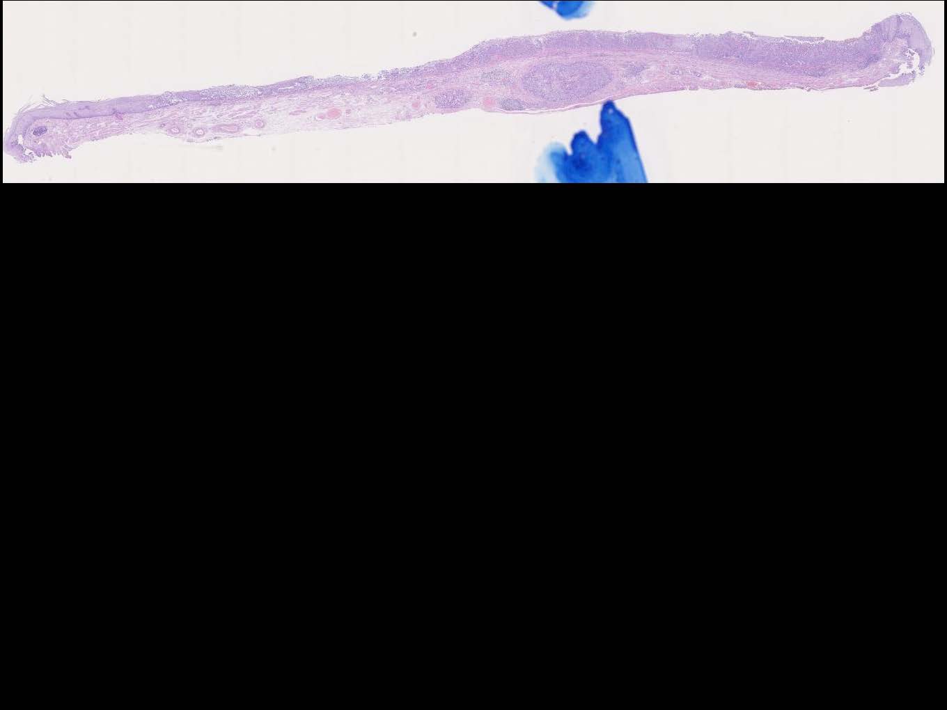 食道040