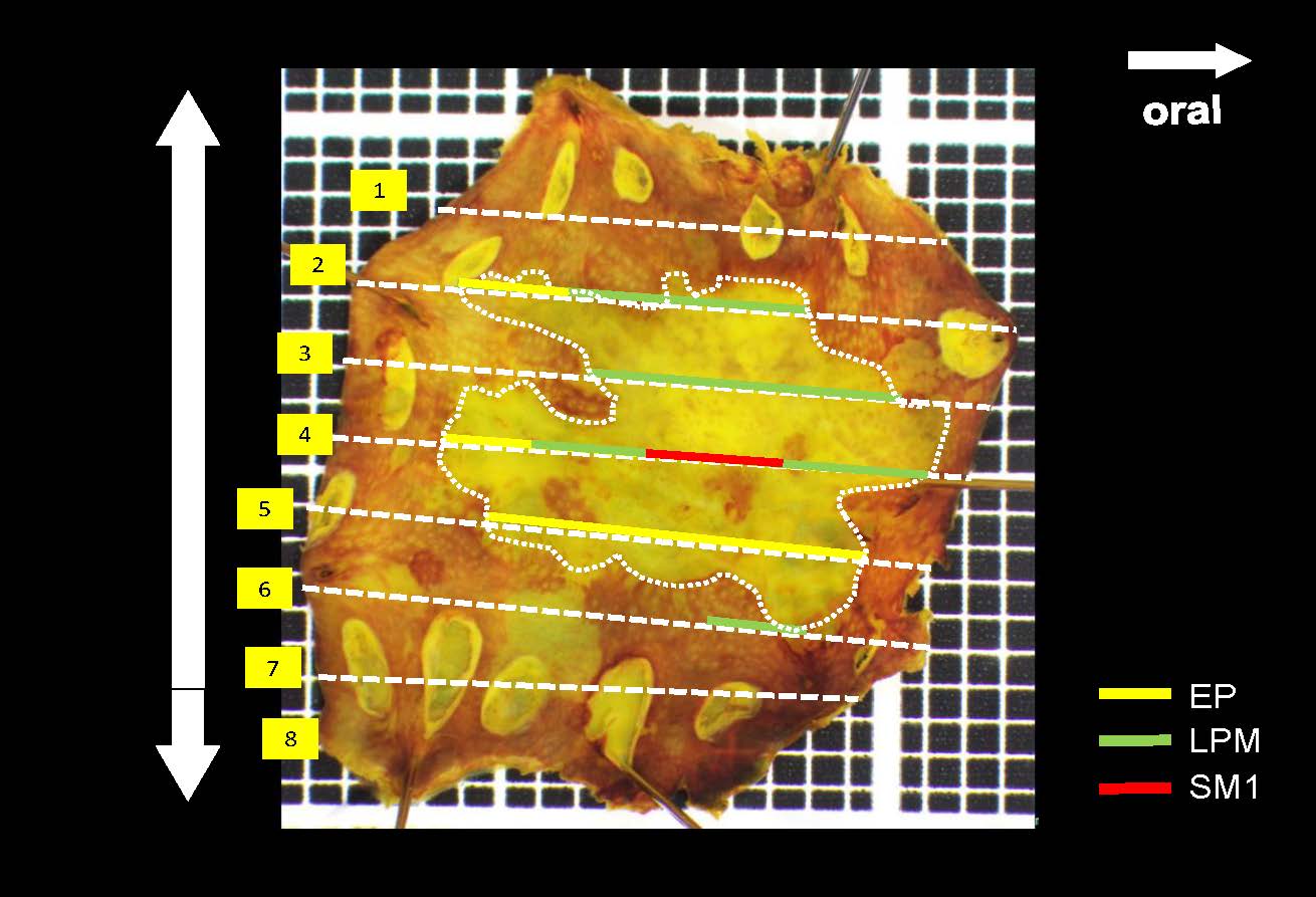食道056