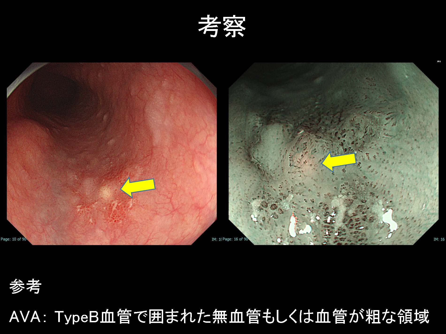 食道063