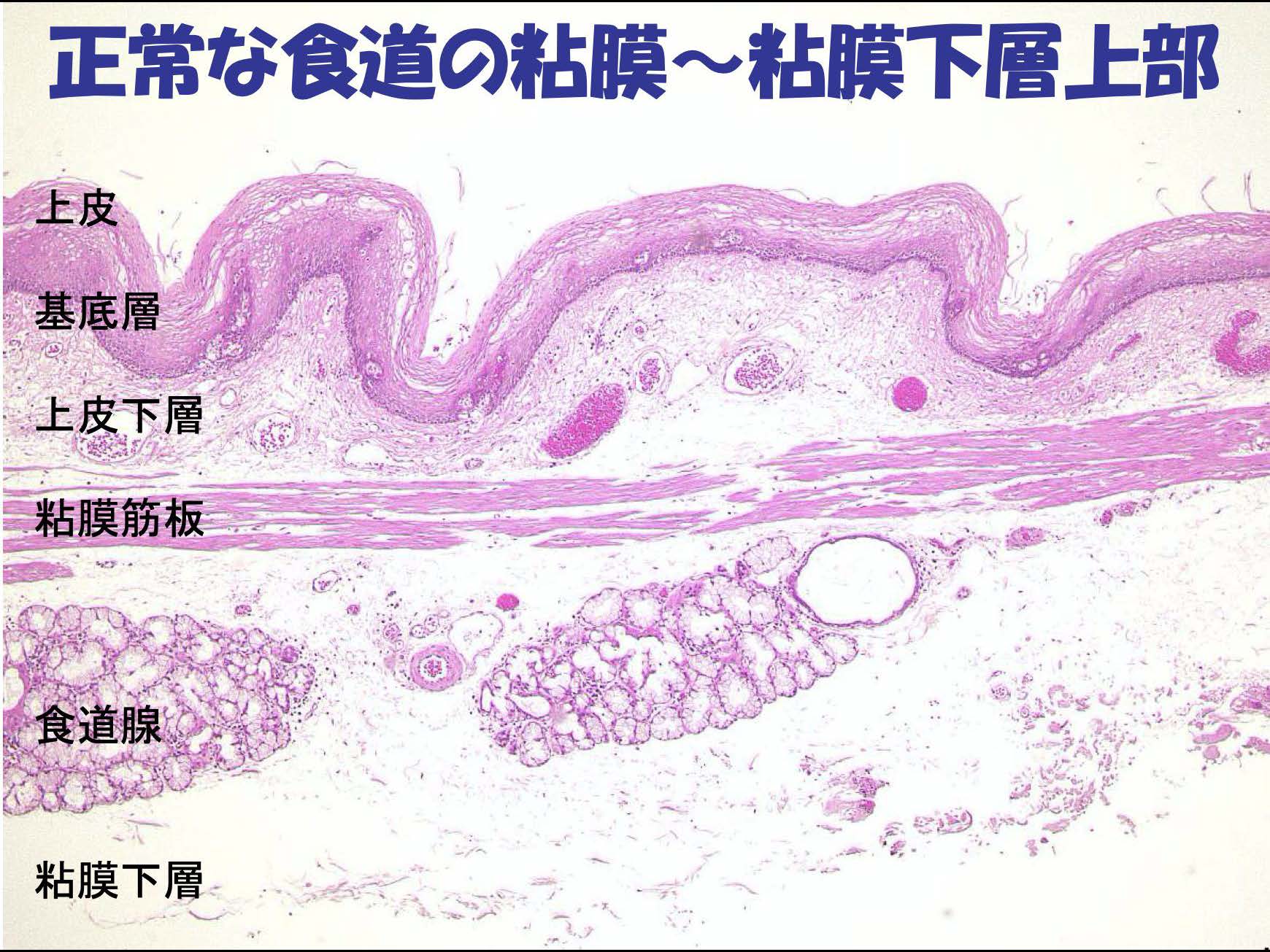 食道068