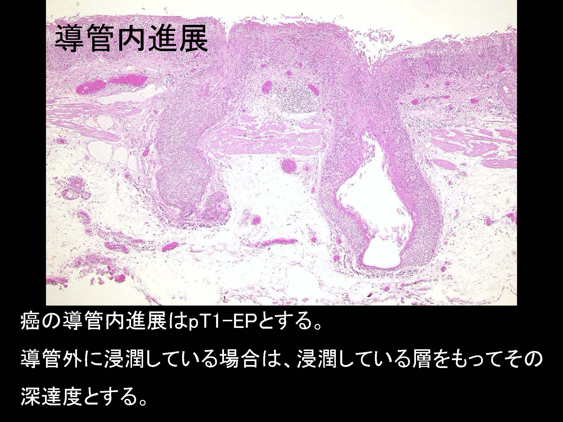 食道069