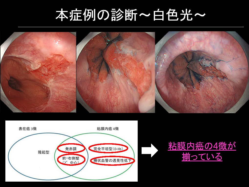 食道106