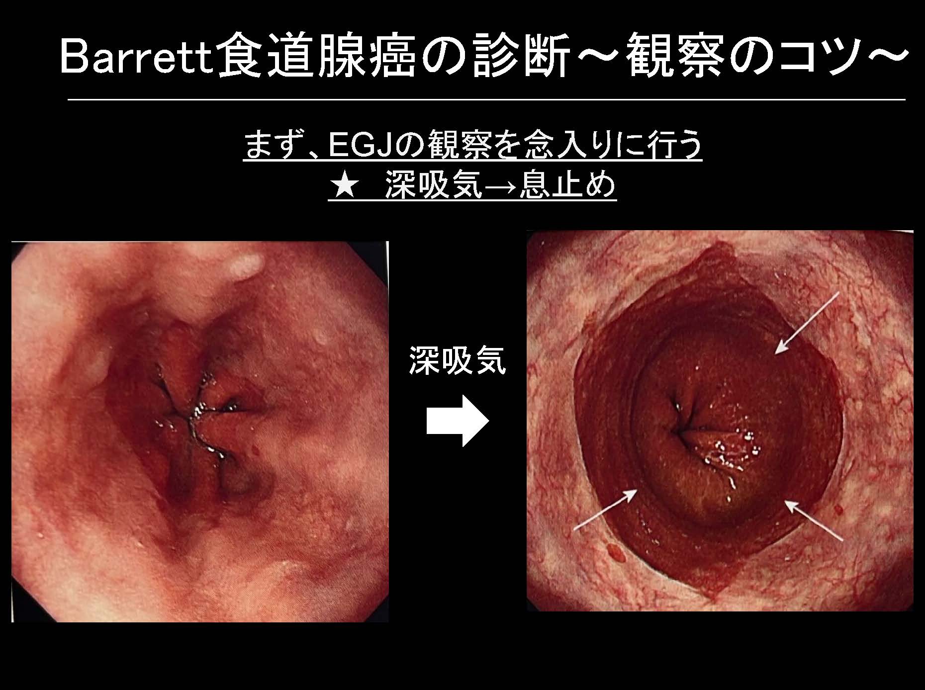 食道108