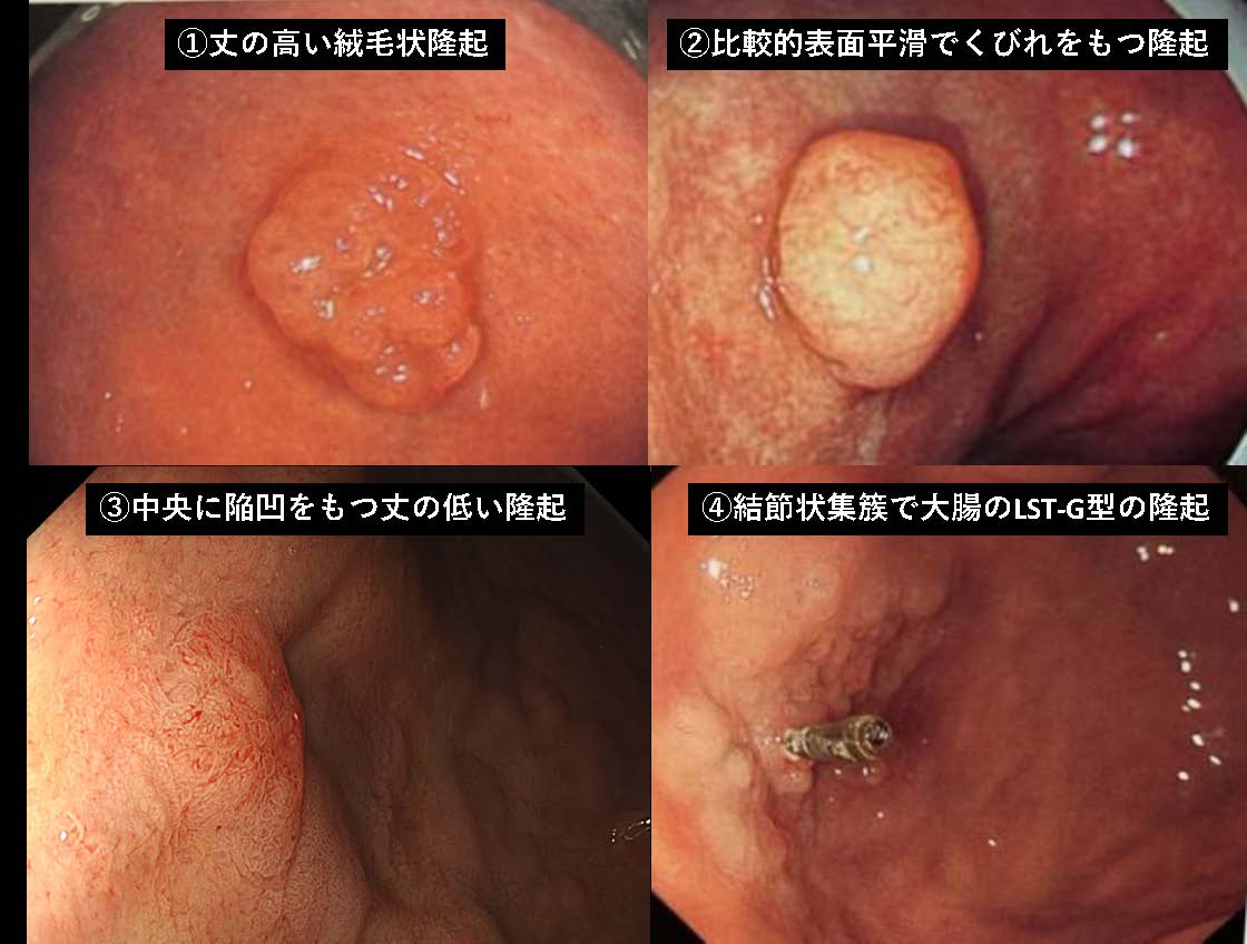 胃058