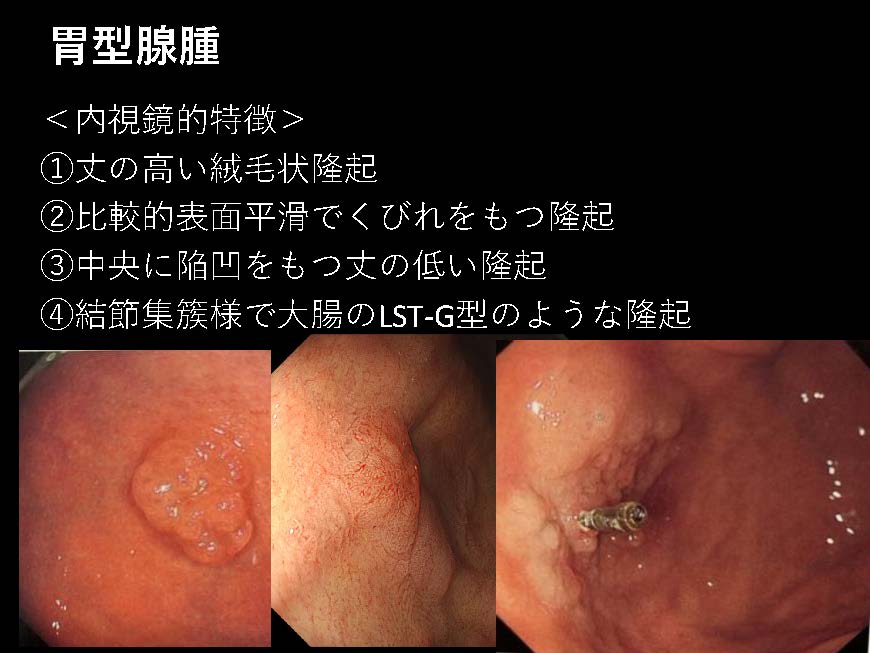 胃069