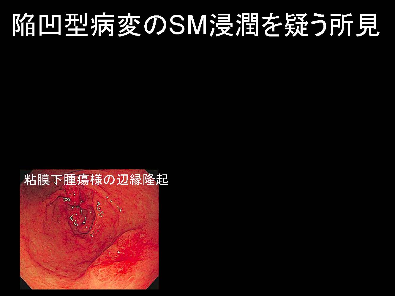 胃096