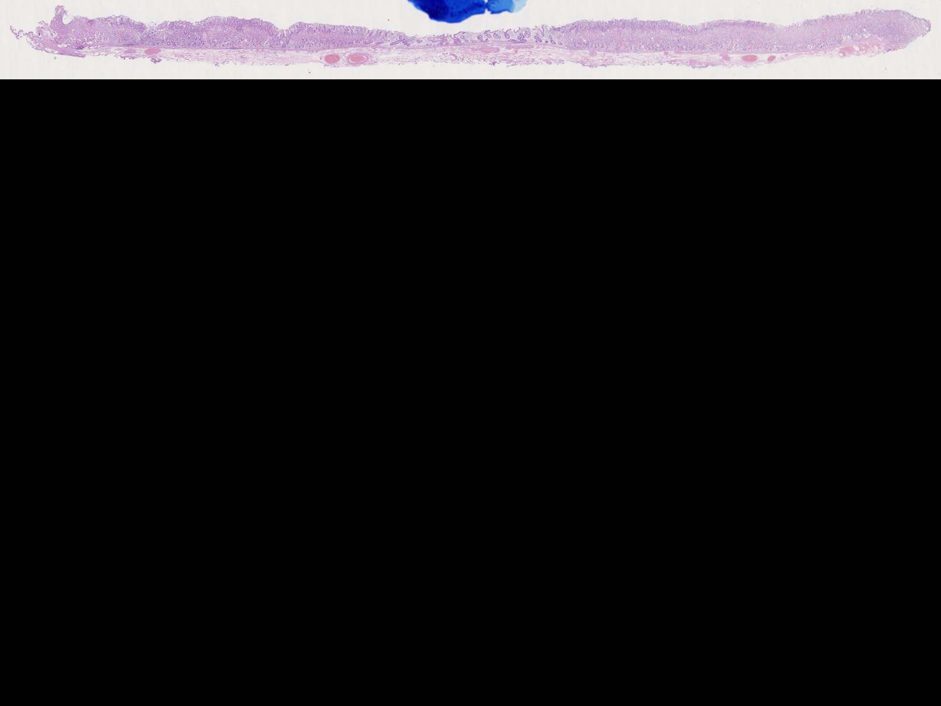 胃039