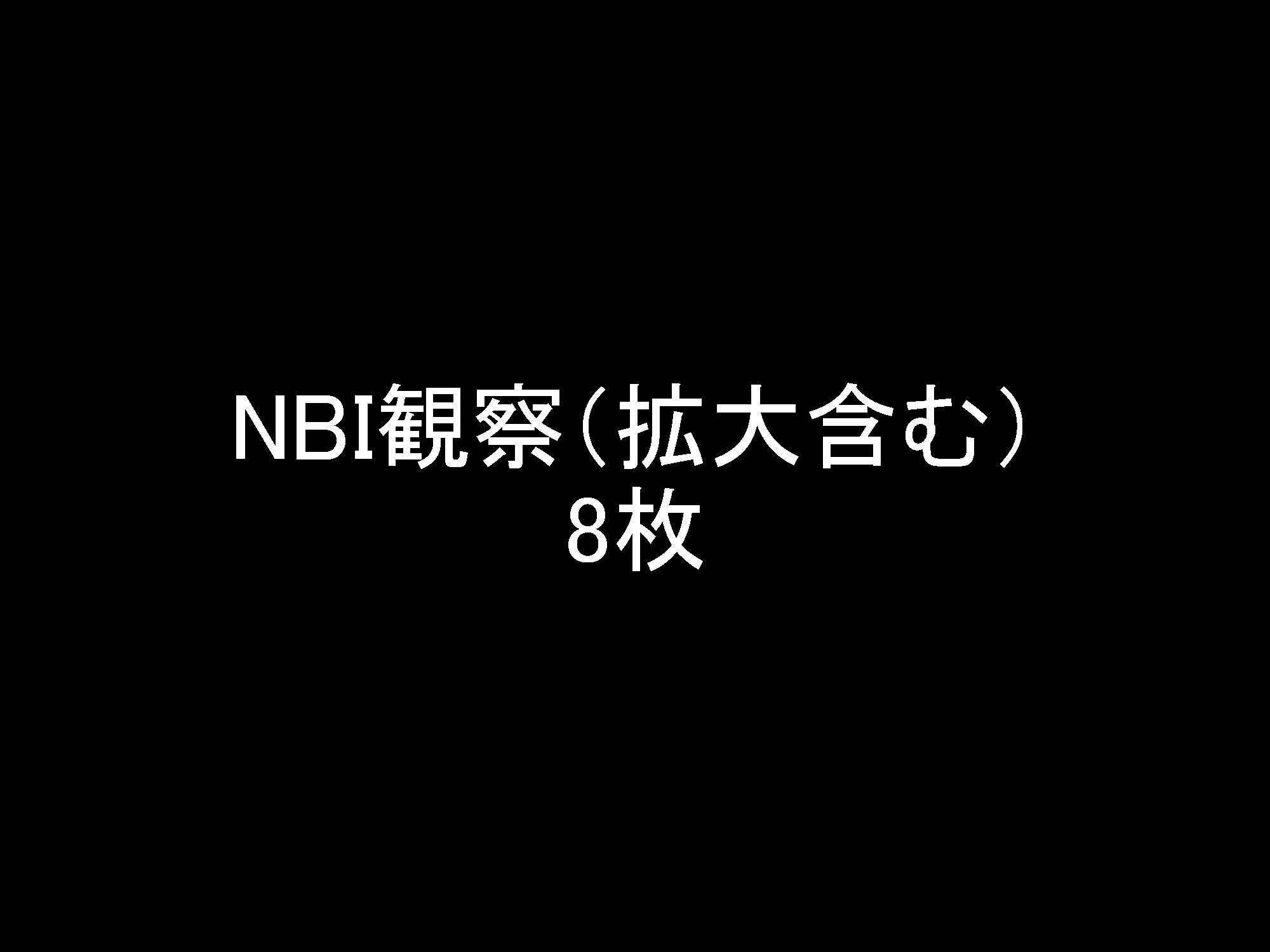 大腸009