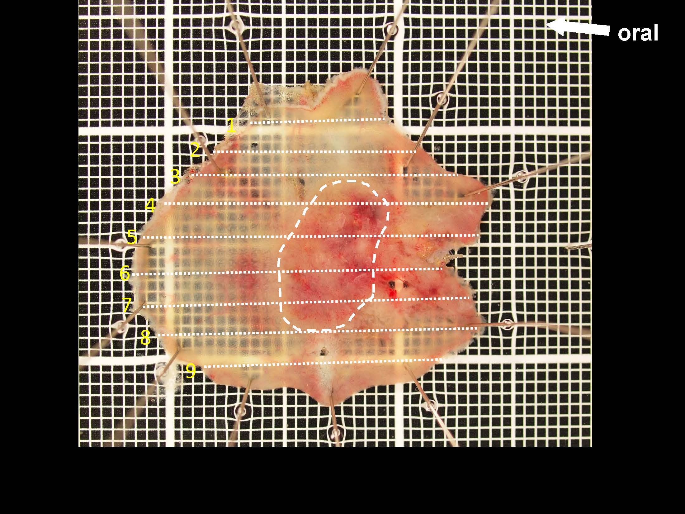 大腸034