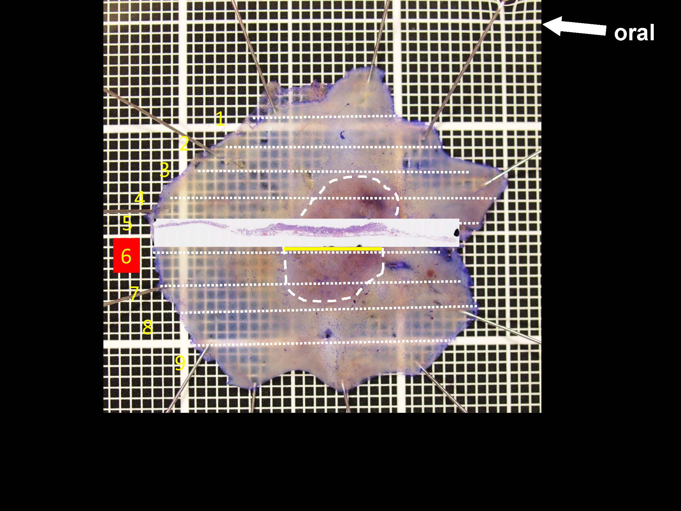 大腸043