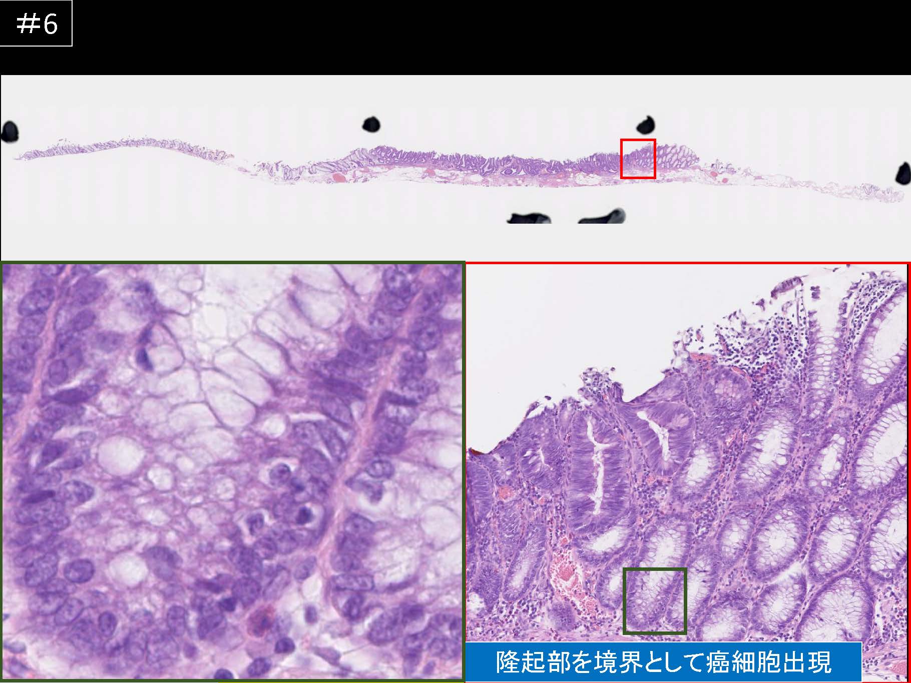 大腸048