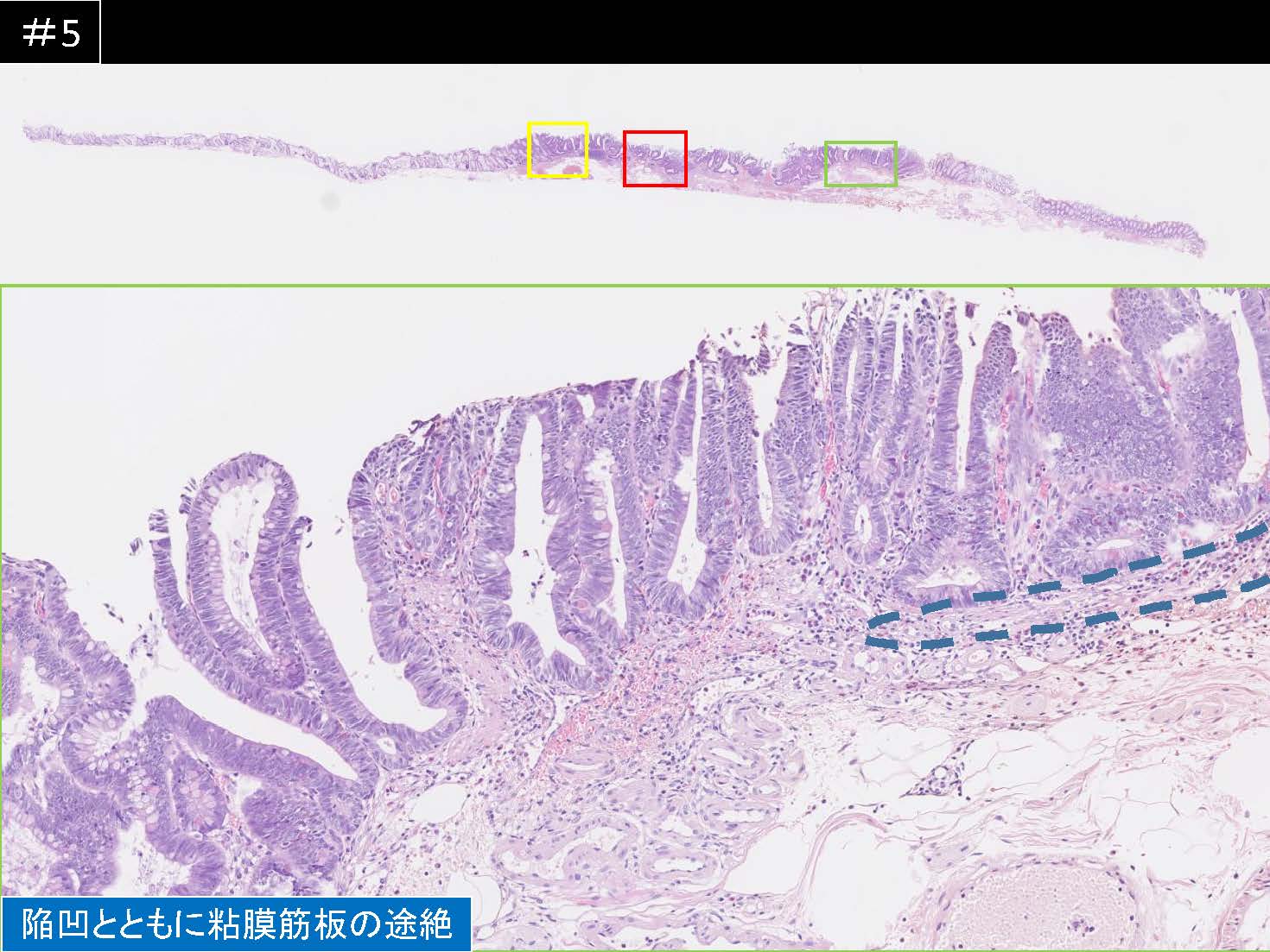 大腸058