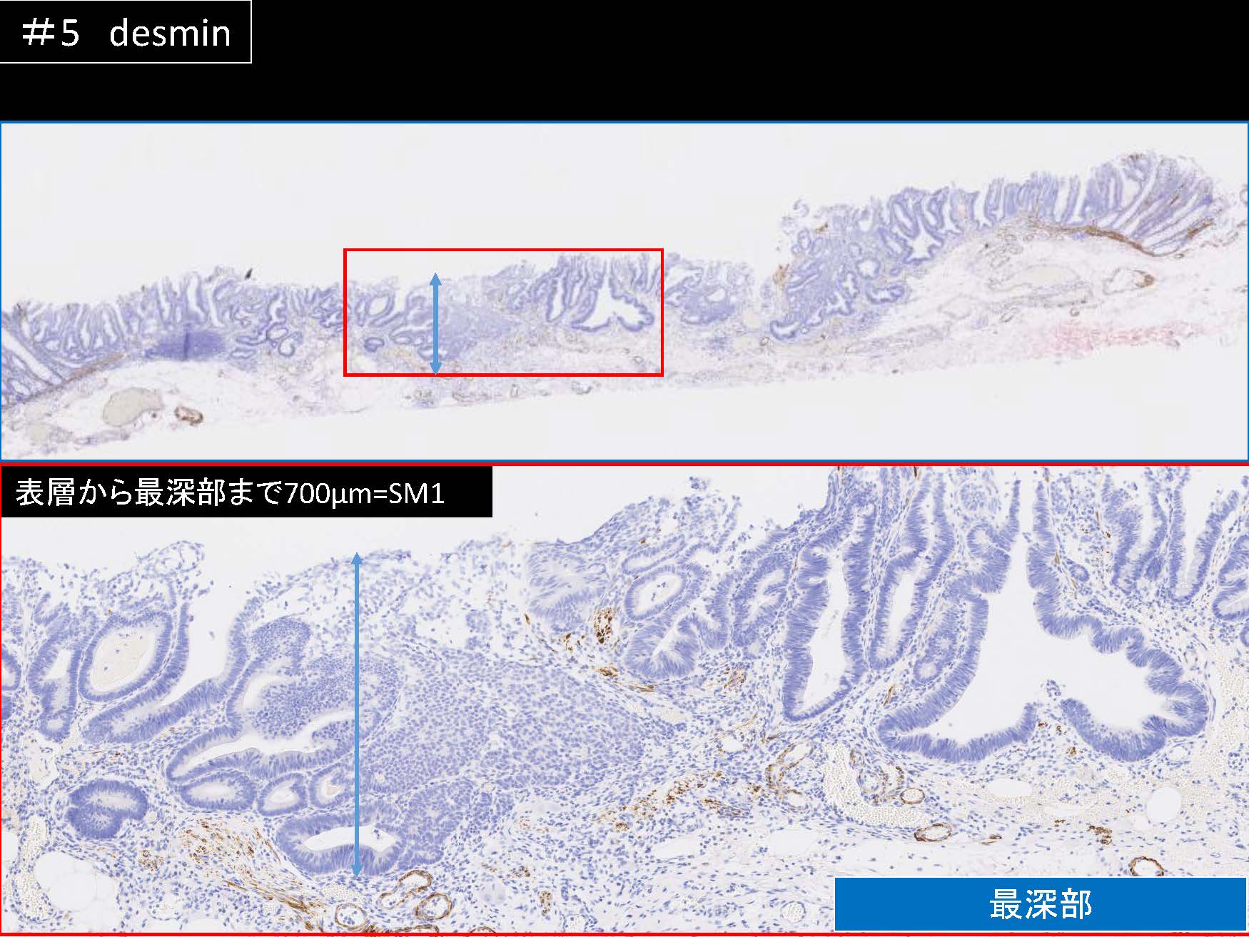 大腸063